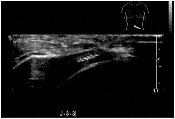 Multimode mammary gland developing target and dedicated device for releasing target