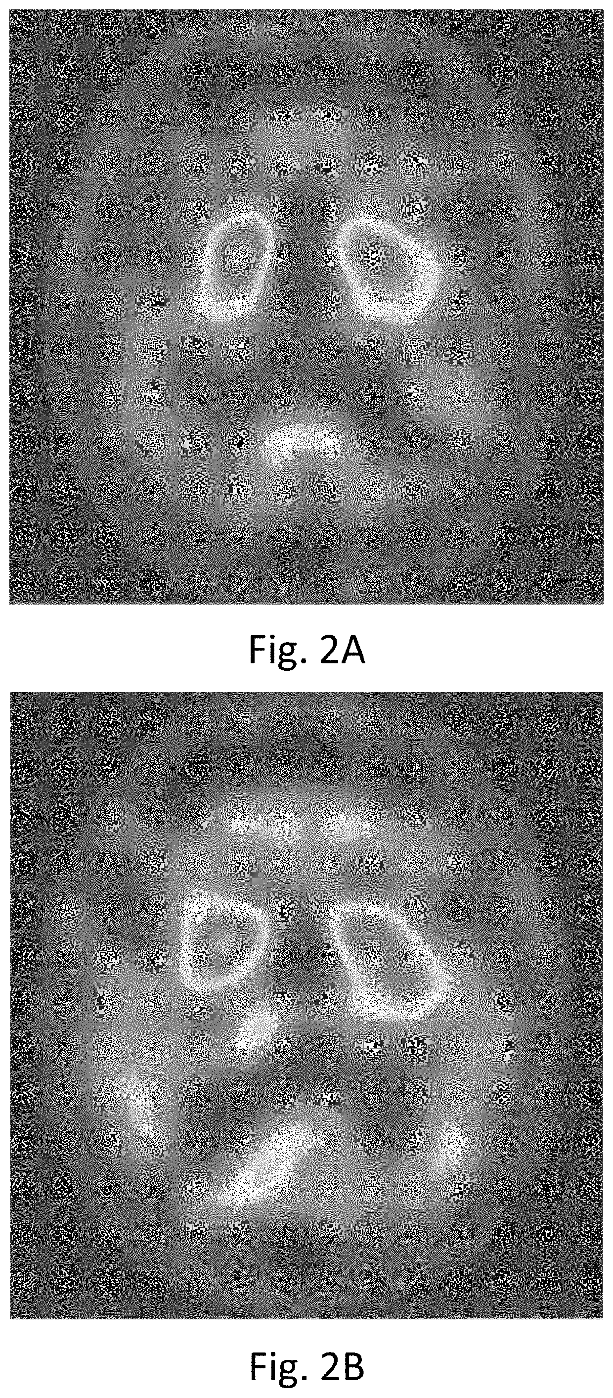 Method of independent or adjuvant treatment of Parkinson's disease and Parkinson's syndrome