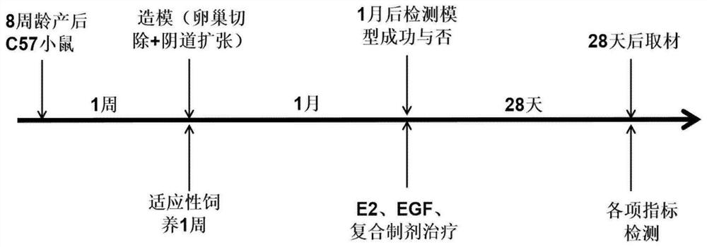 Traditional Chinese and western medicine combined compound preparation and application thereof