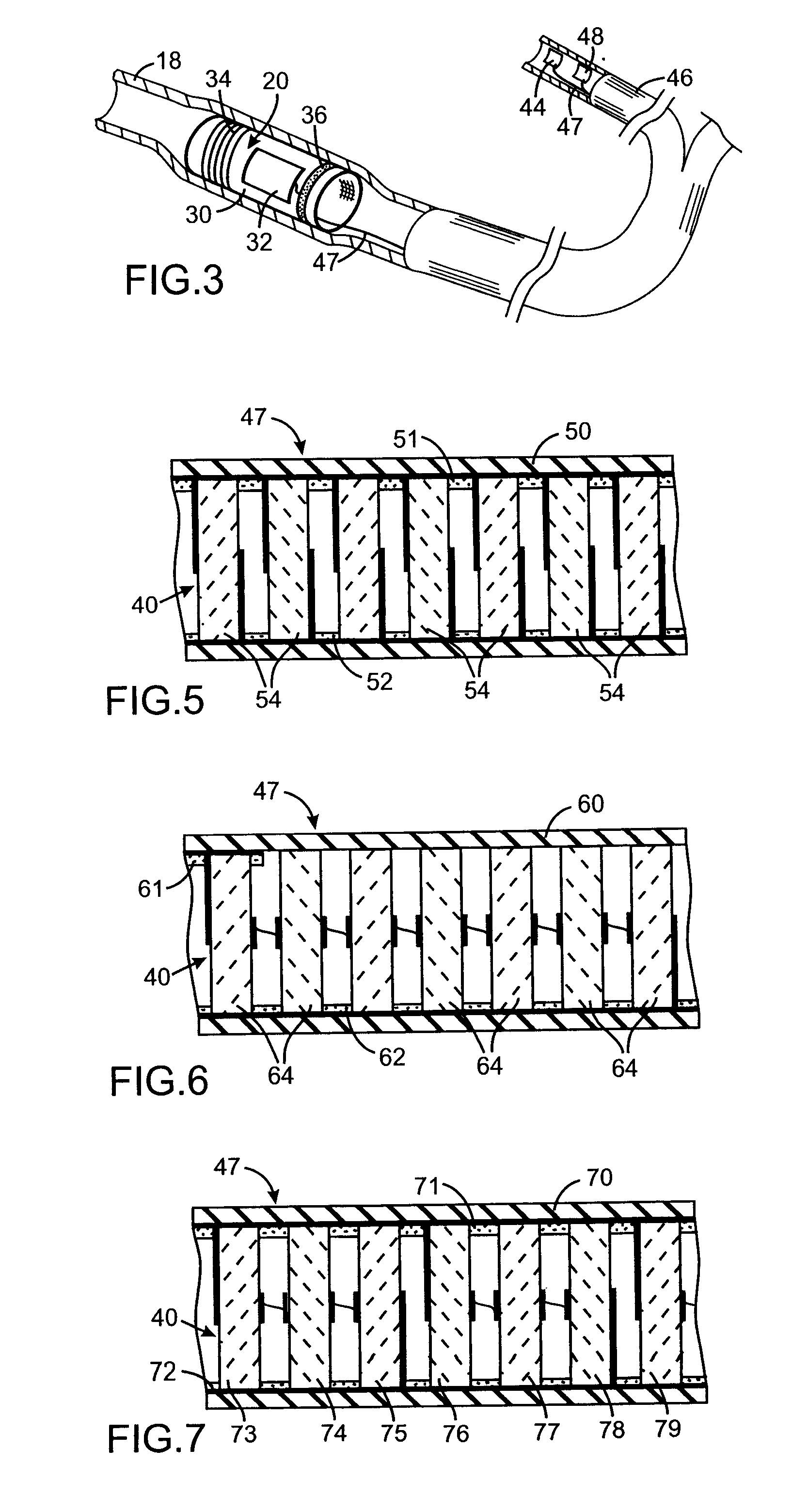 Medical Device With Intra-Conductor Capacitive Energy Storage