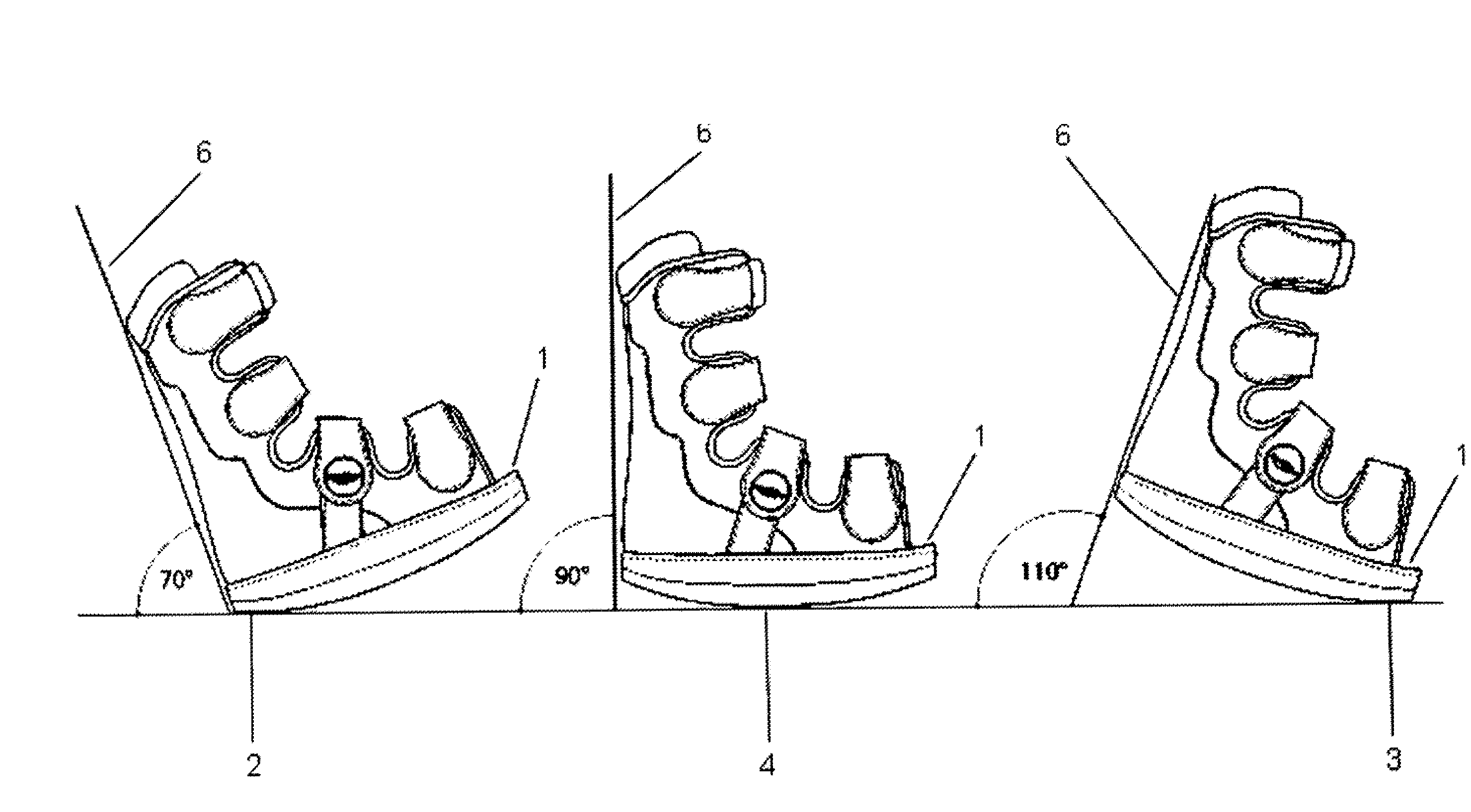 Footwear orthosis