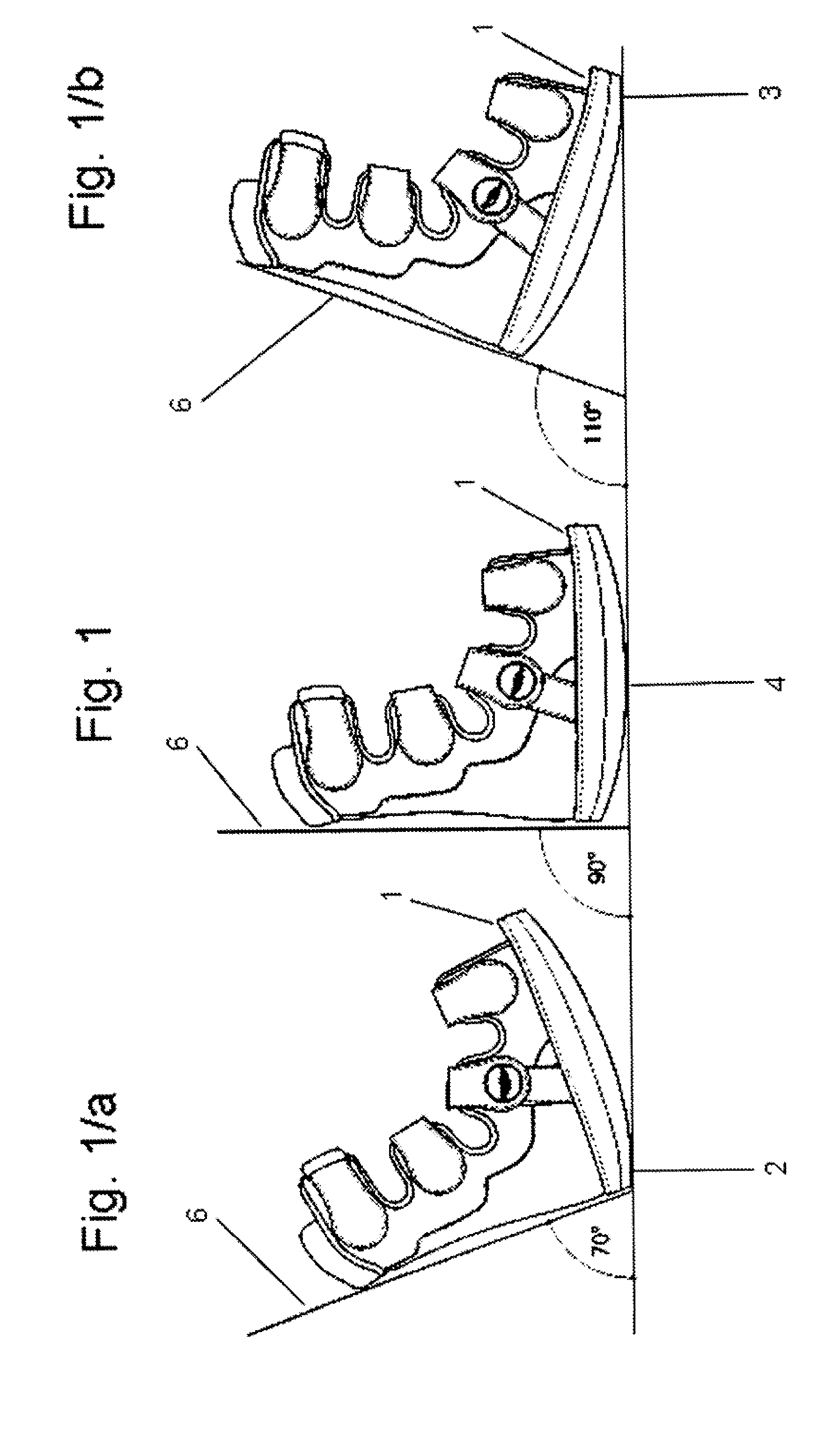 Footwear orthosis