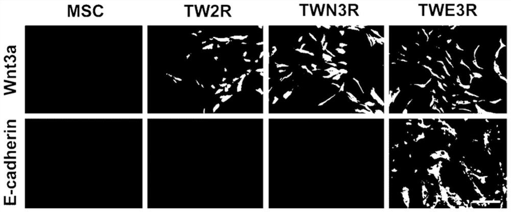 Preparation method of human feeder layer cells capable of supporting growth of human embryonic stem cells