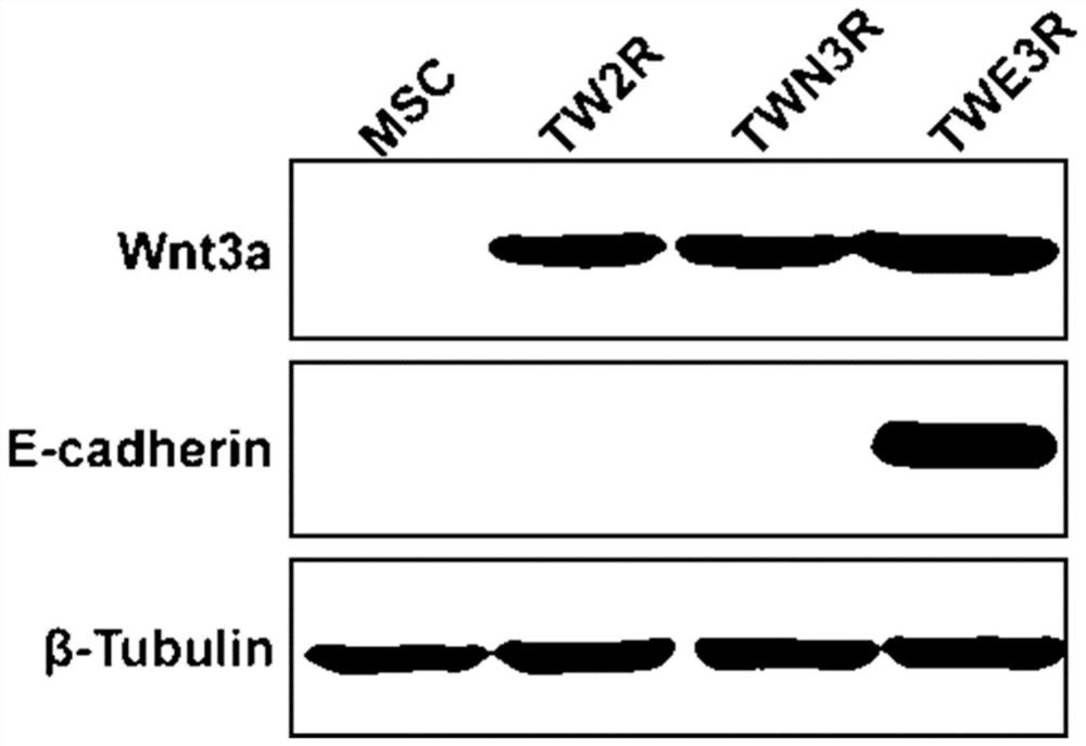 Preparation method of human feeder layer cells capable of supporting growth of human embryonic stem cells