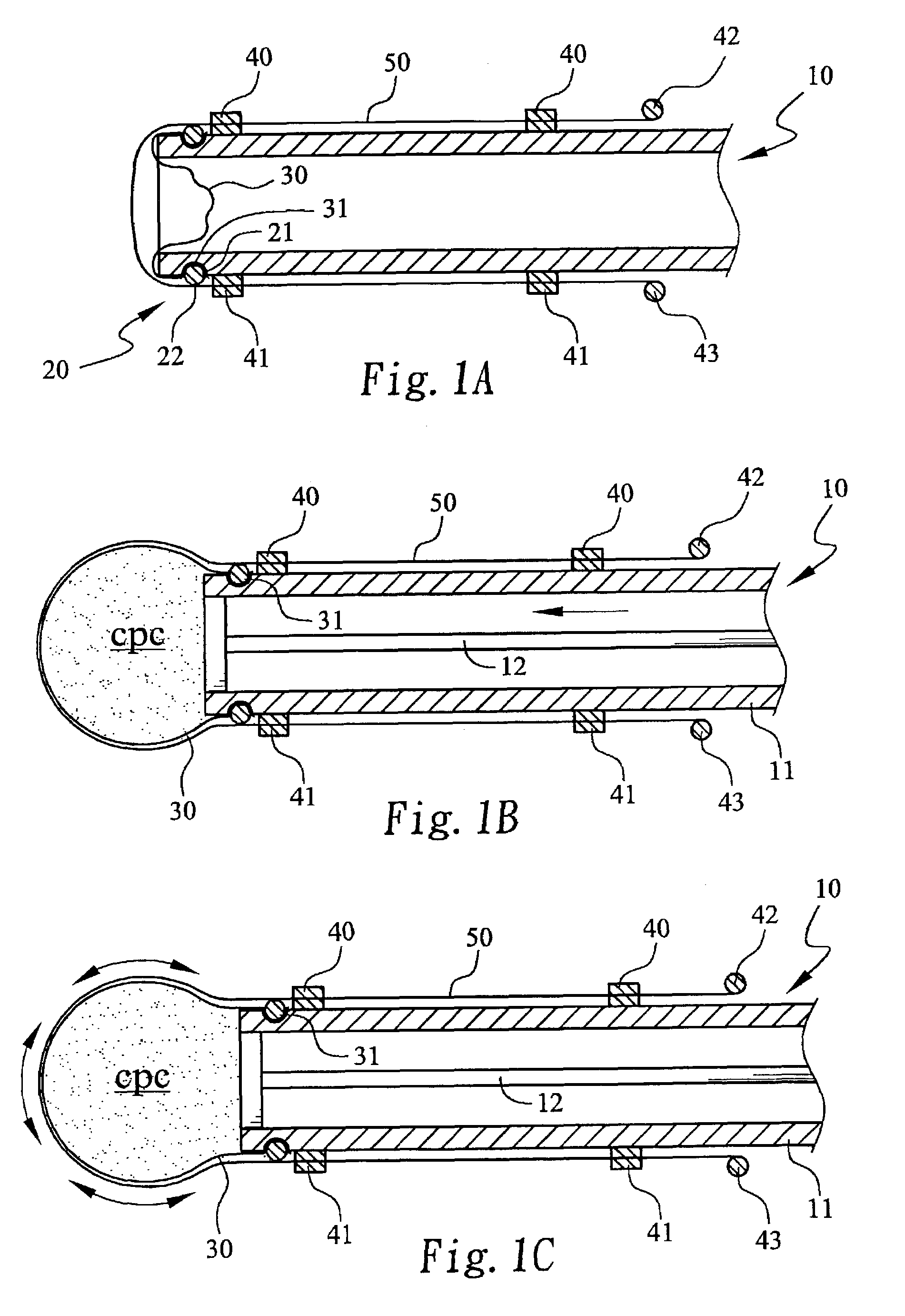 Method and device for forming a hardened cement in a bone cavity