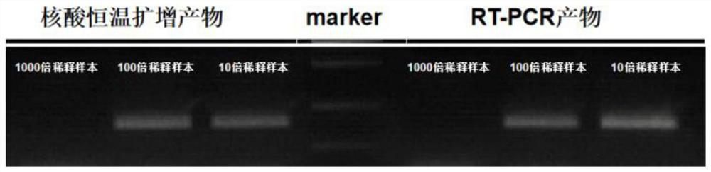 2019-nCoV nucleic acid isothermal amplification detection kit based on SYBR Green I and detection method