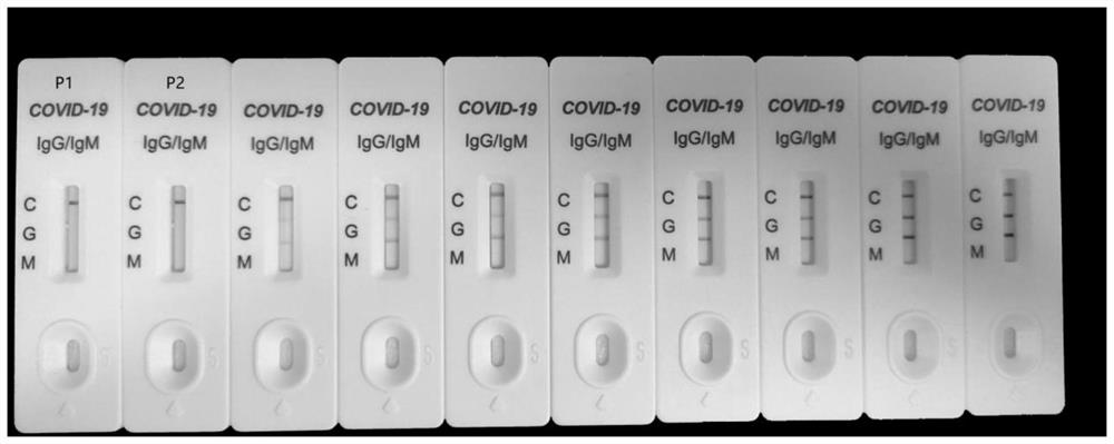 2019-nCoV nucleic acid isothermal amplification detection kit based on SYBR Green I and detection method