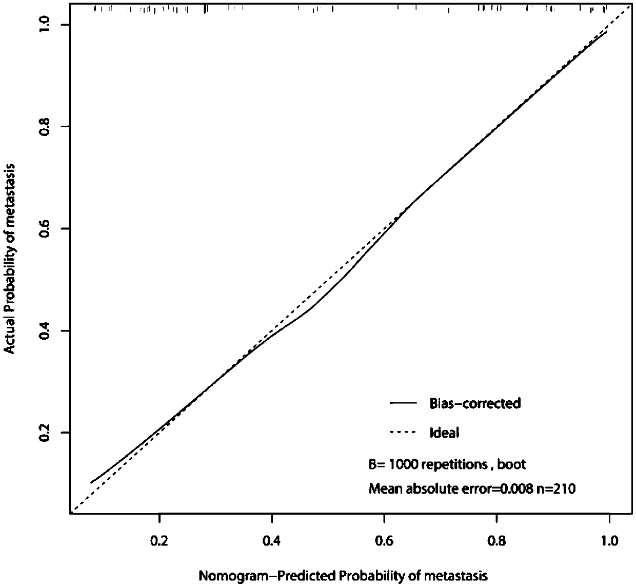 Progression appendicitis nomogram prediction model and application thereof