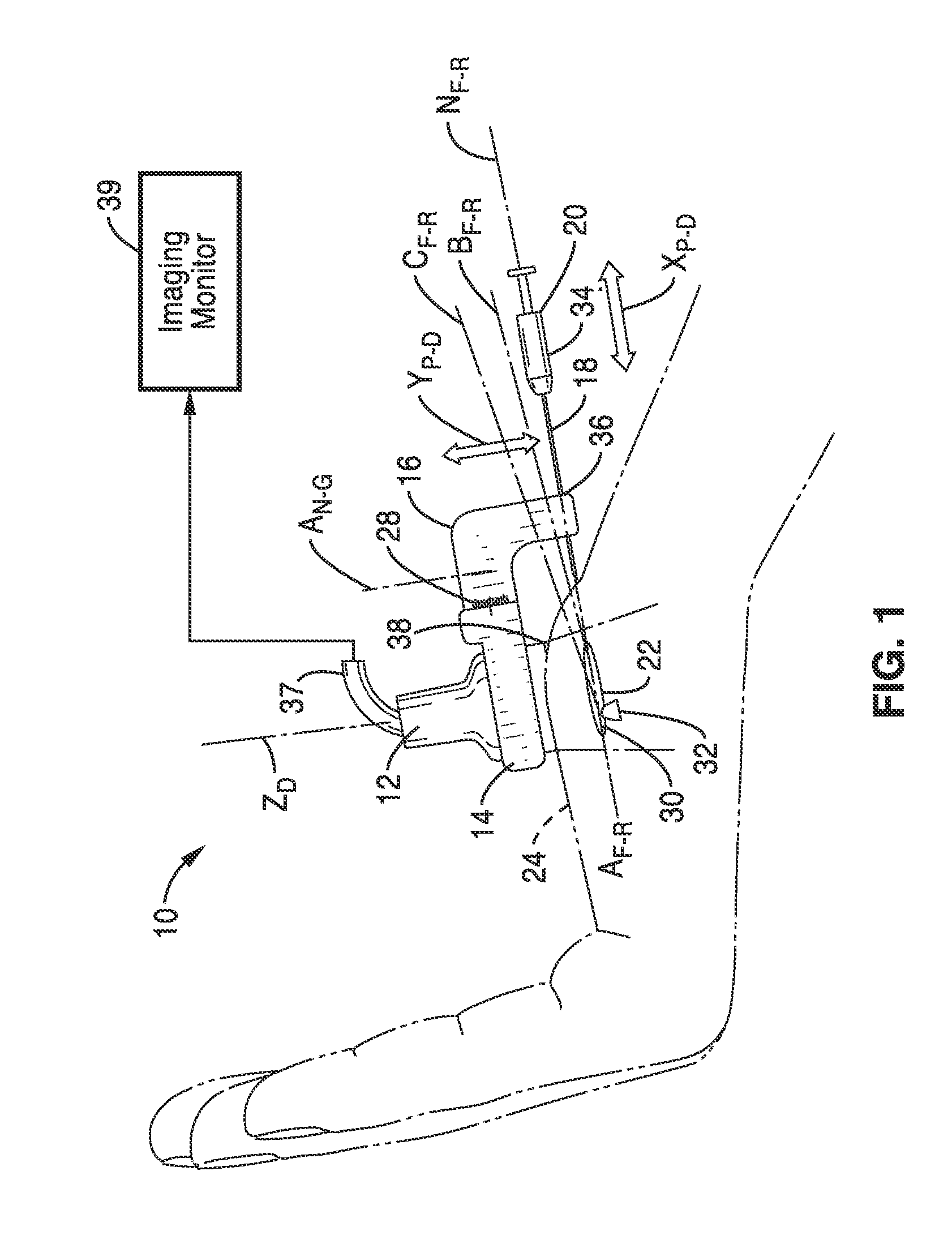 Treatment of carpal tunnel syndrome by injection of the flexor retinaculum