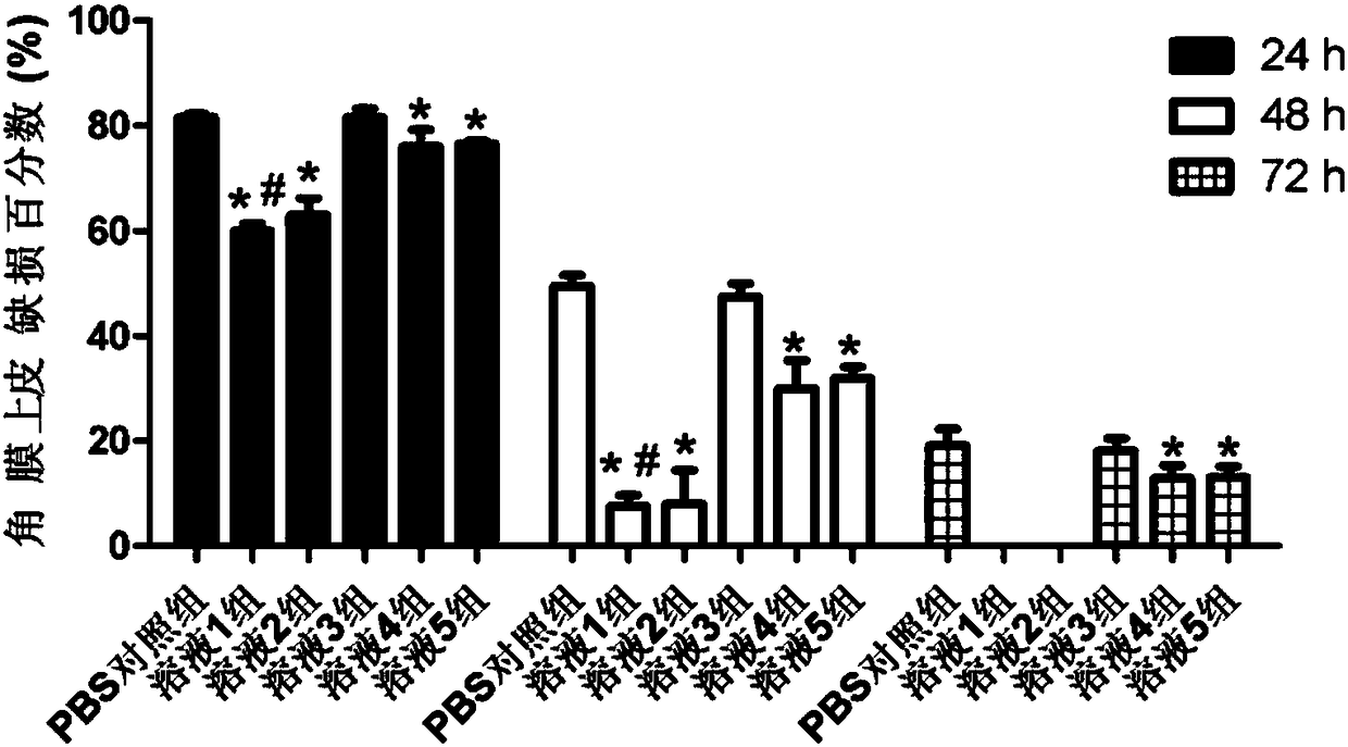 Astragaloside eye drops with high water solubility and high stability as well as preparation method thereof