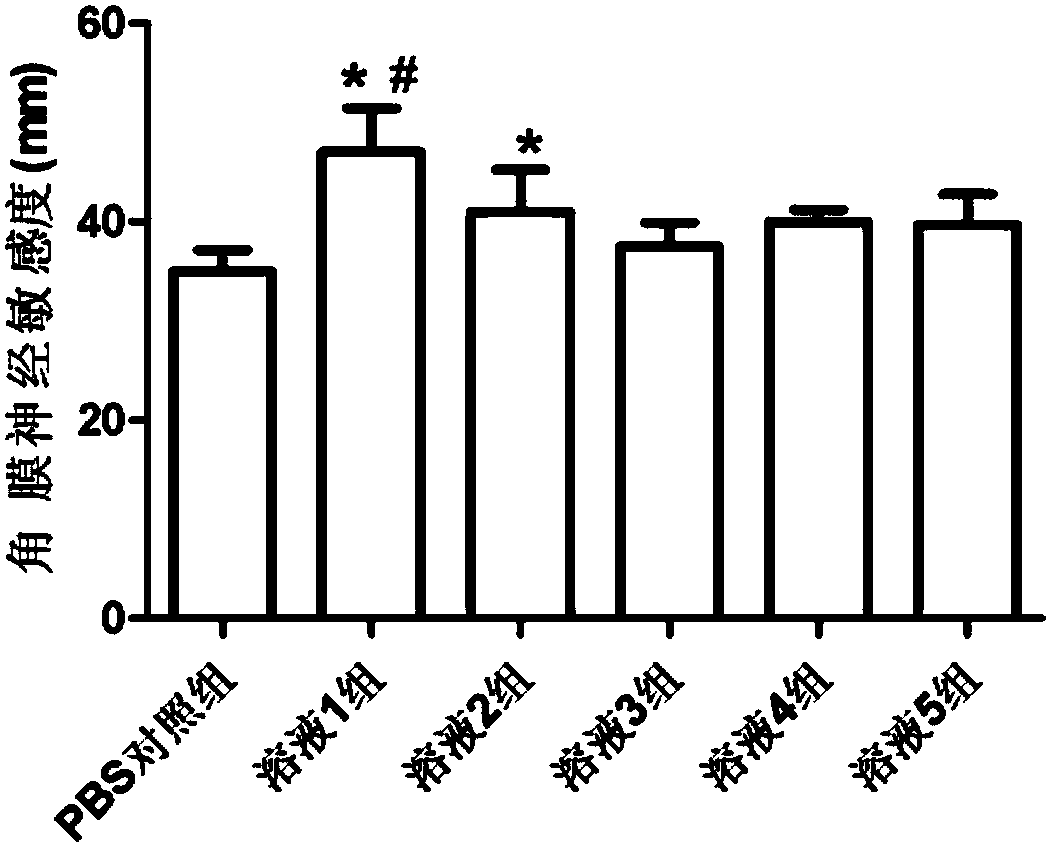 Astragaloside eye drops with high water solubility and high stability as well as preparation method thereof