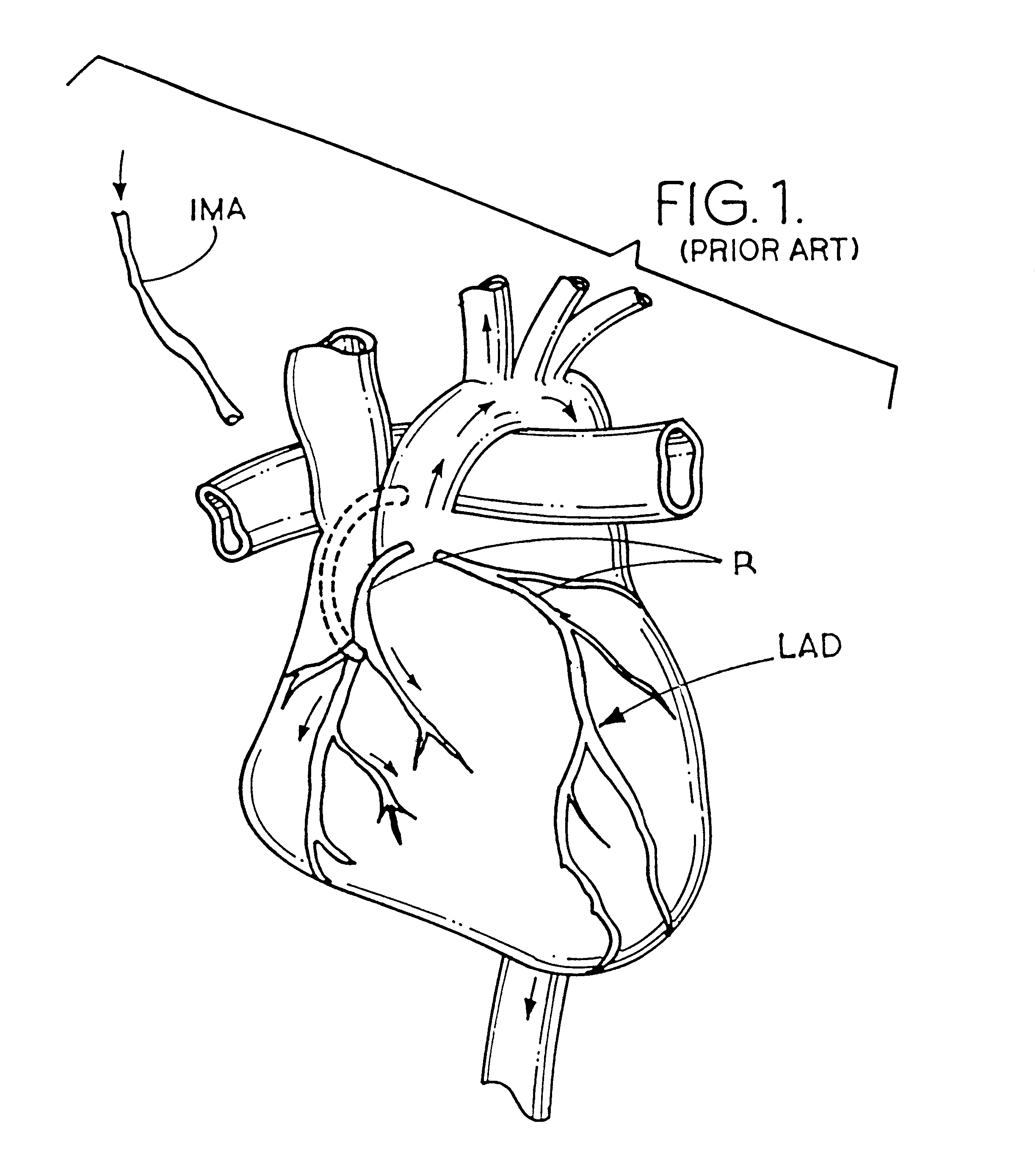 Apparatus and method for performing an anastomosis