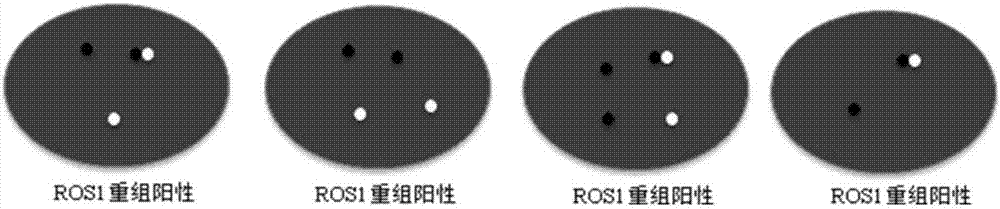 Kit and detection method for abnormity of ROS1 and C-met genes