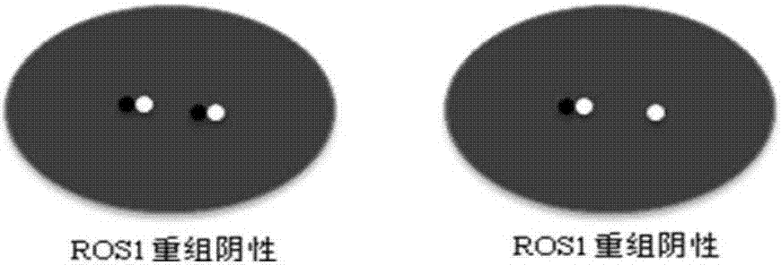 Kit and detection method for abnormity of ROS1 and C-met genes