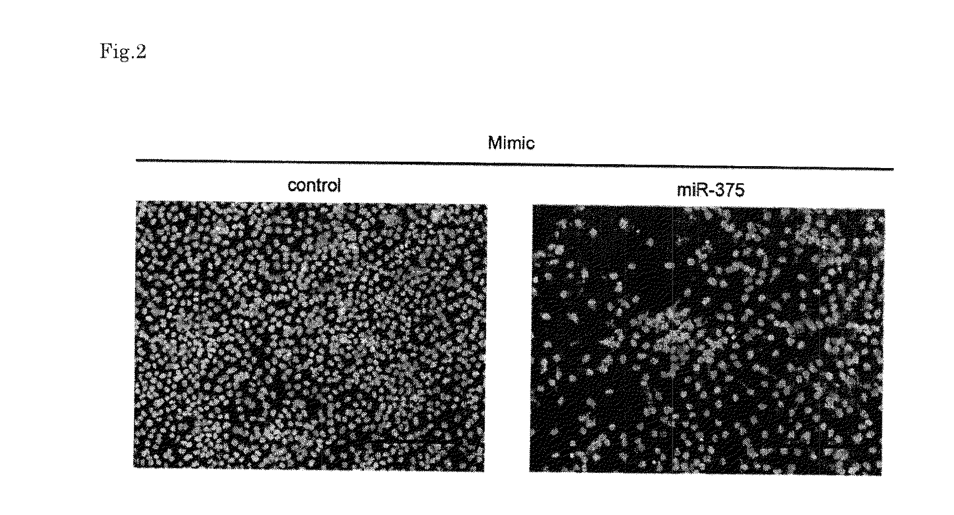 Head-and-neck tumor proliferation inhibitor