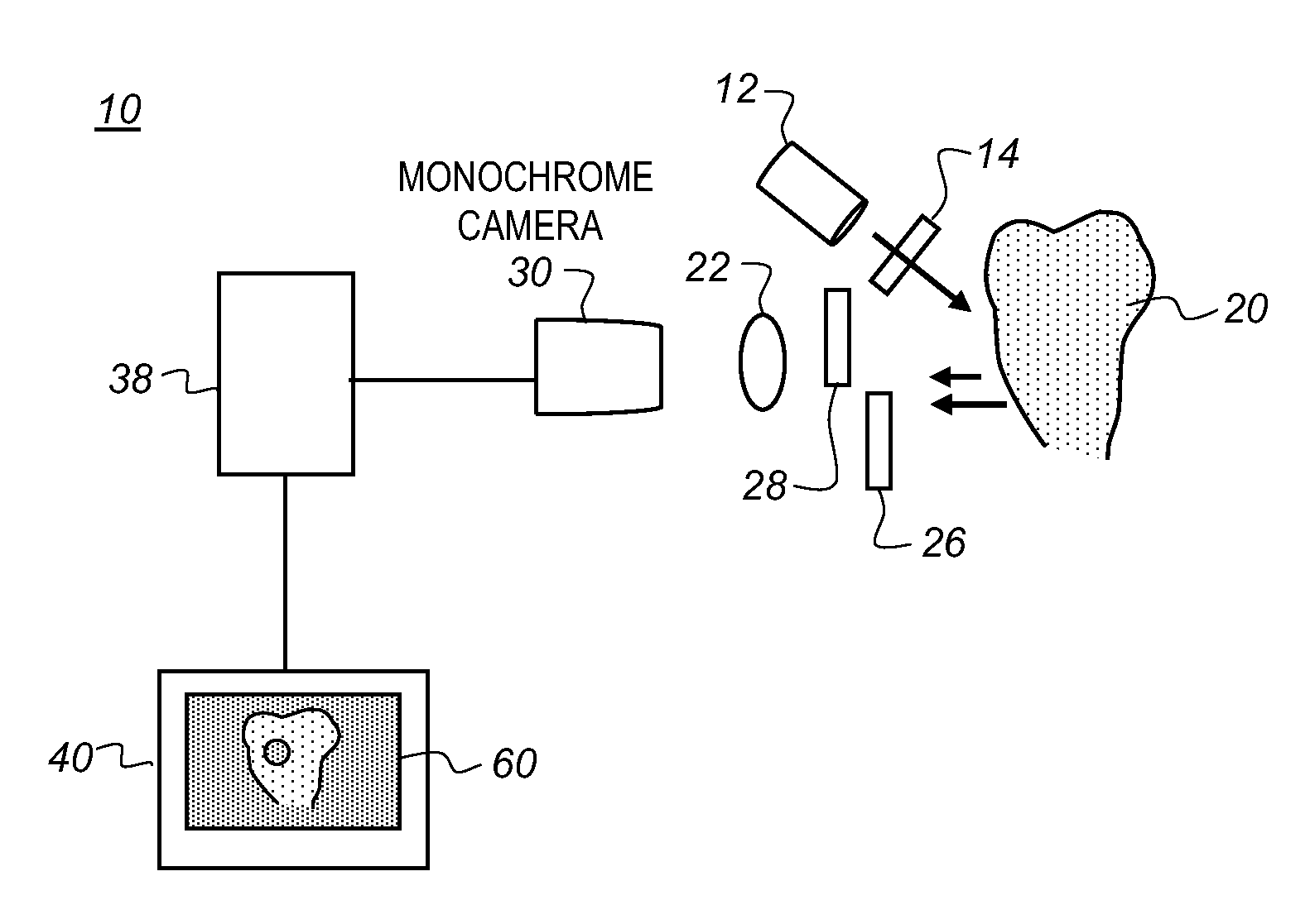 Method and apparatus for detection of caries