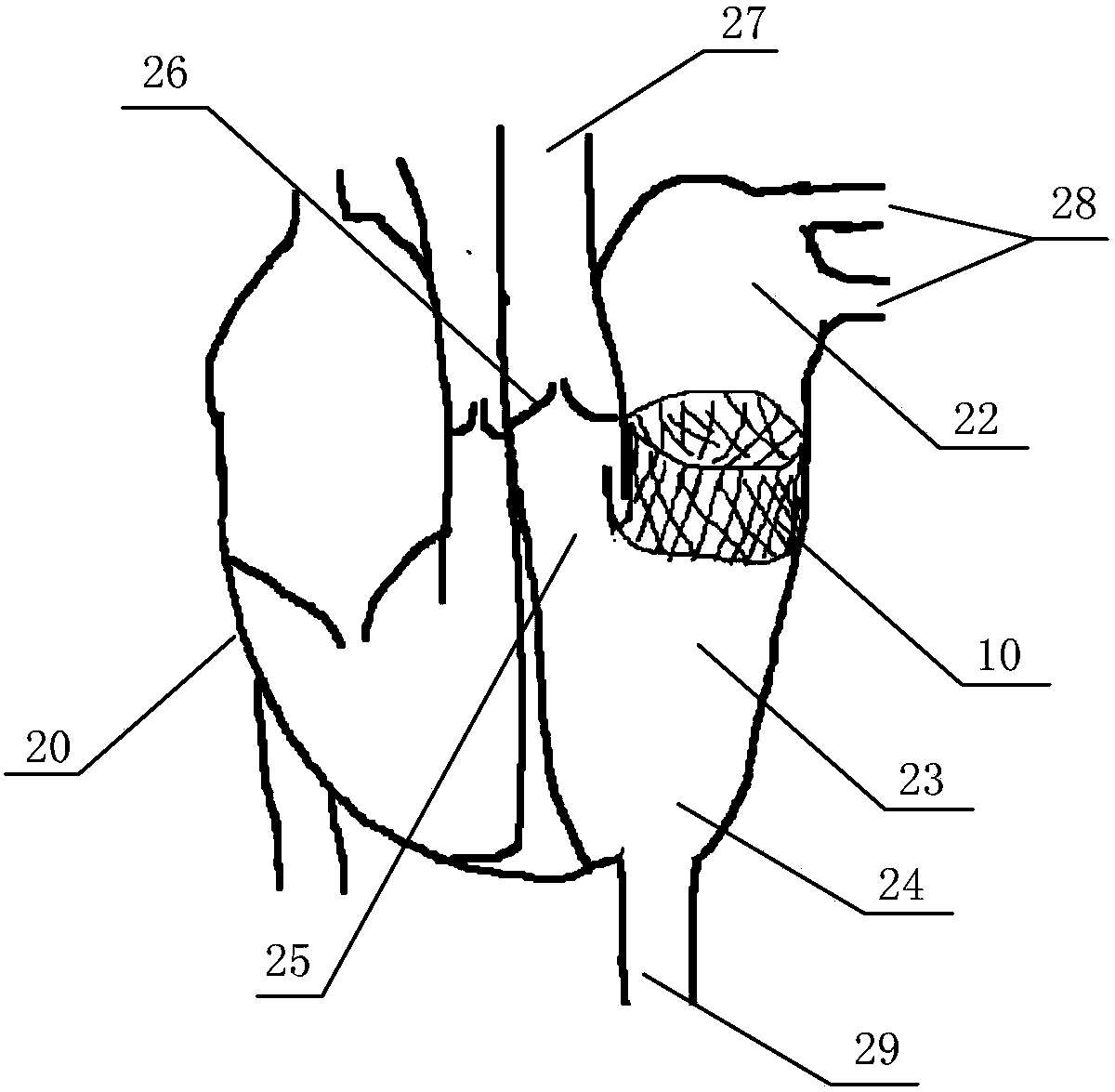 In-vitro performance testing system and testing method of transcatheter bicuspid valve valved stent