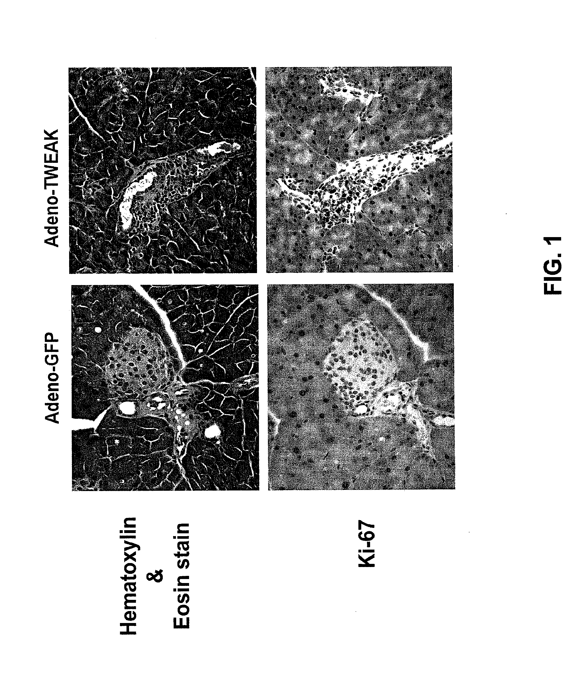 Methods for pancreatic tissue regeneration