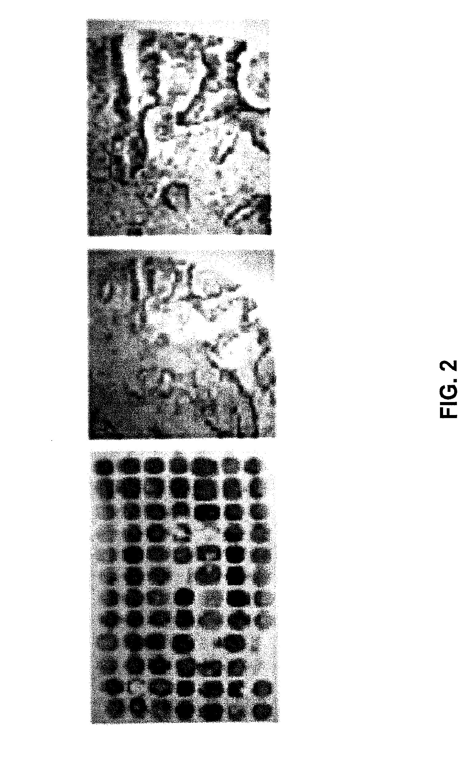 Methods for pancreatic tissue regeneration