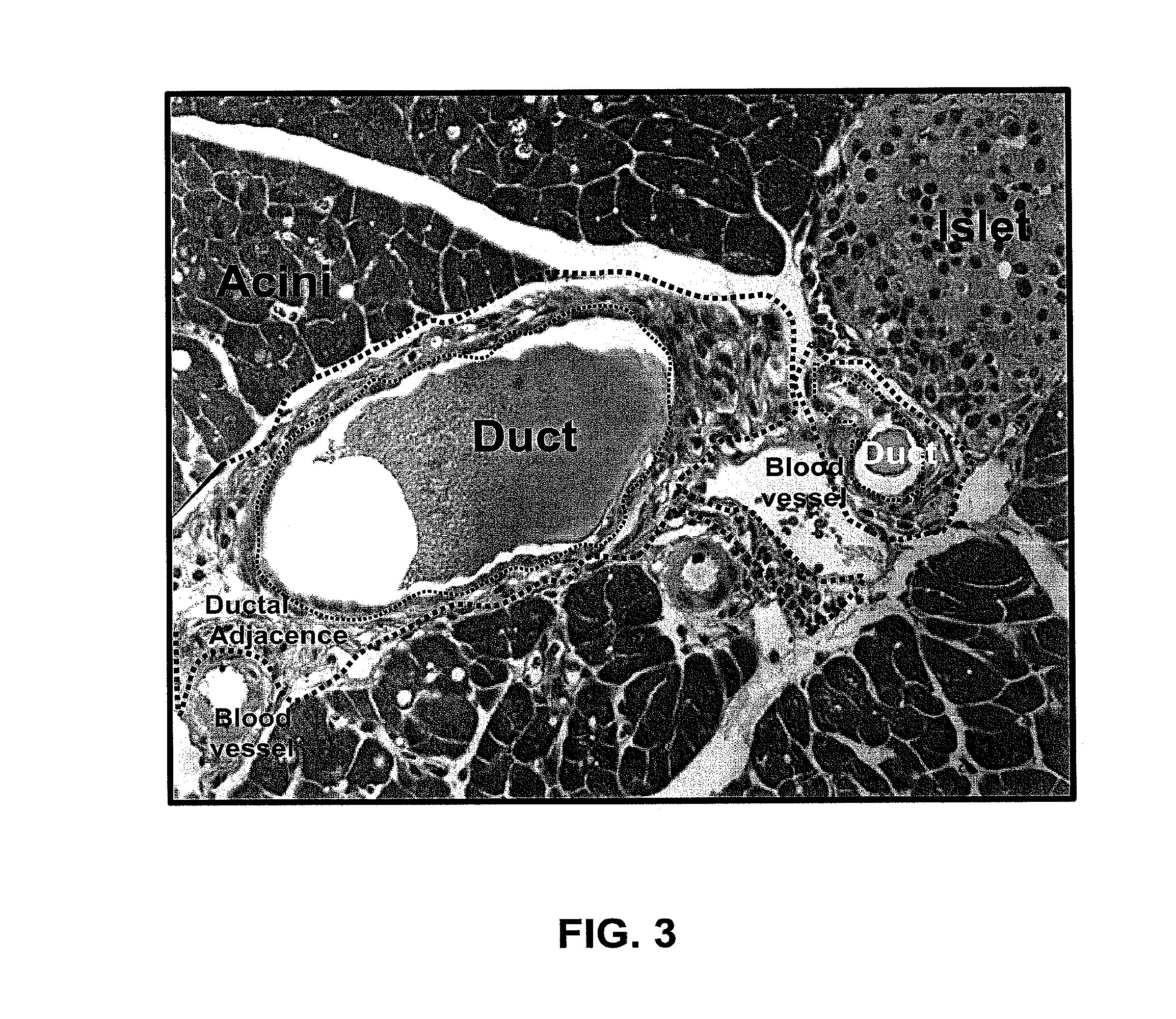 Methods for pancreatic tissue regeneration