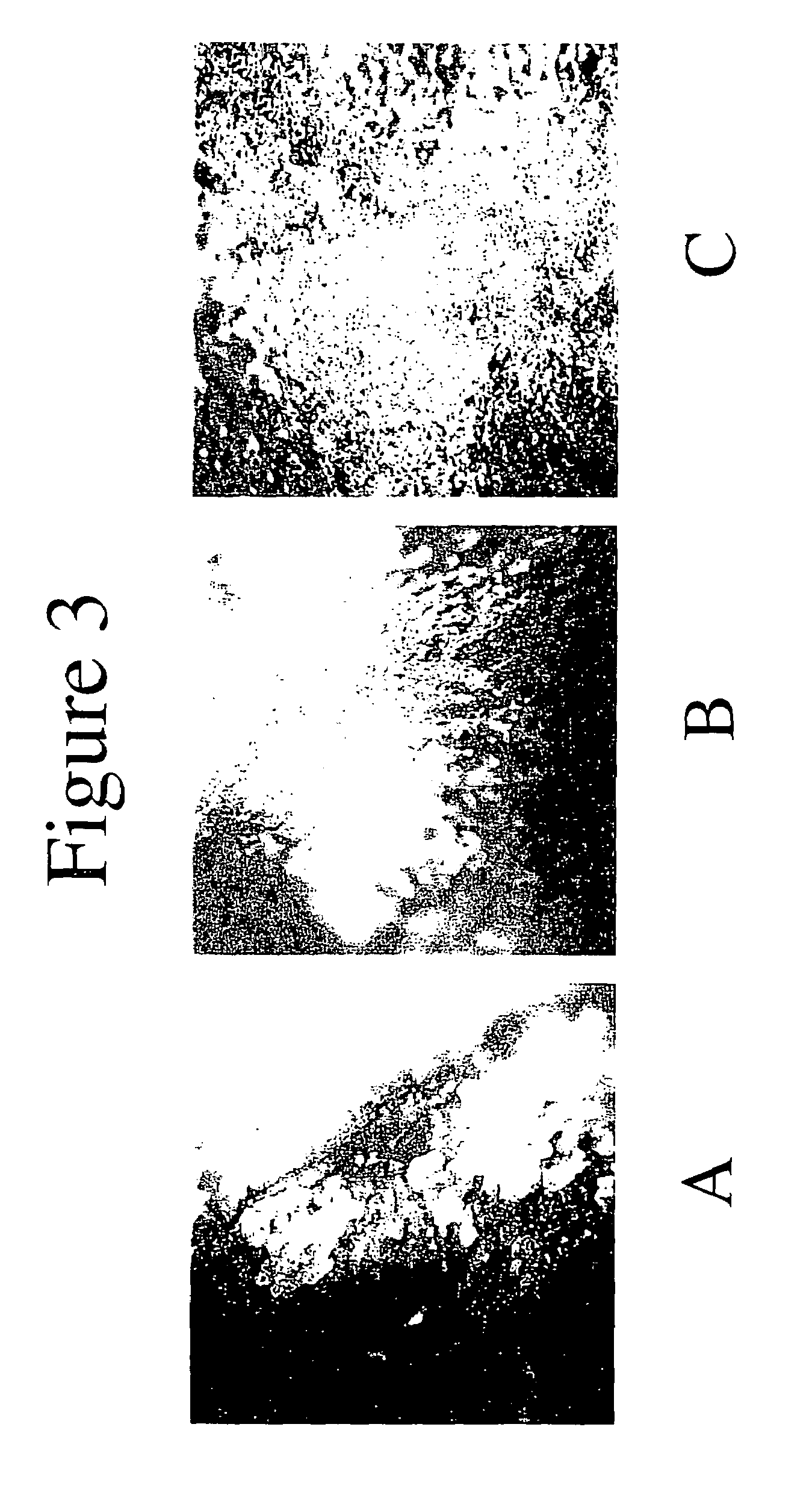 Medical devices with associated growth factors