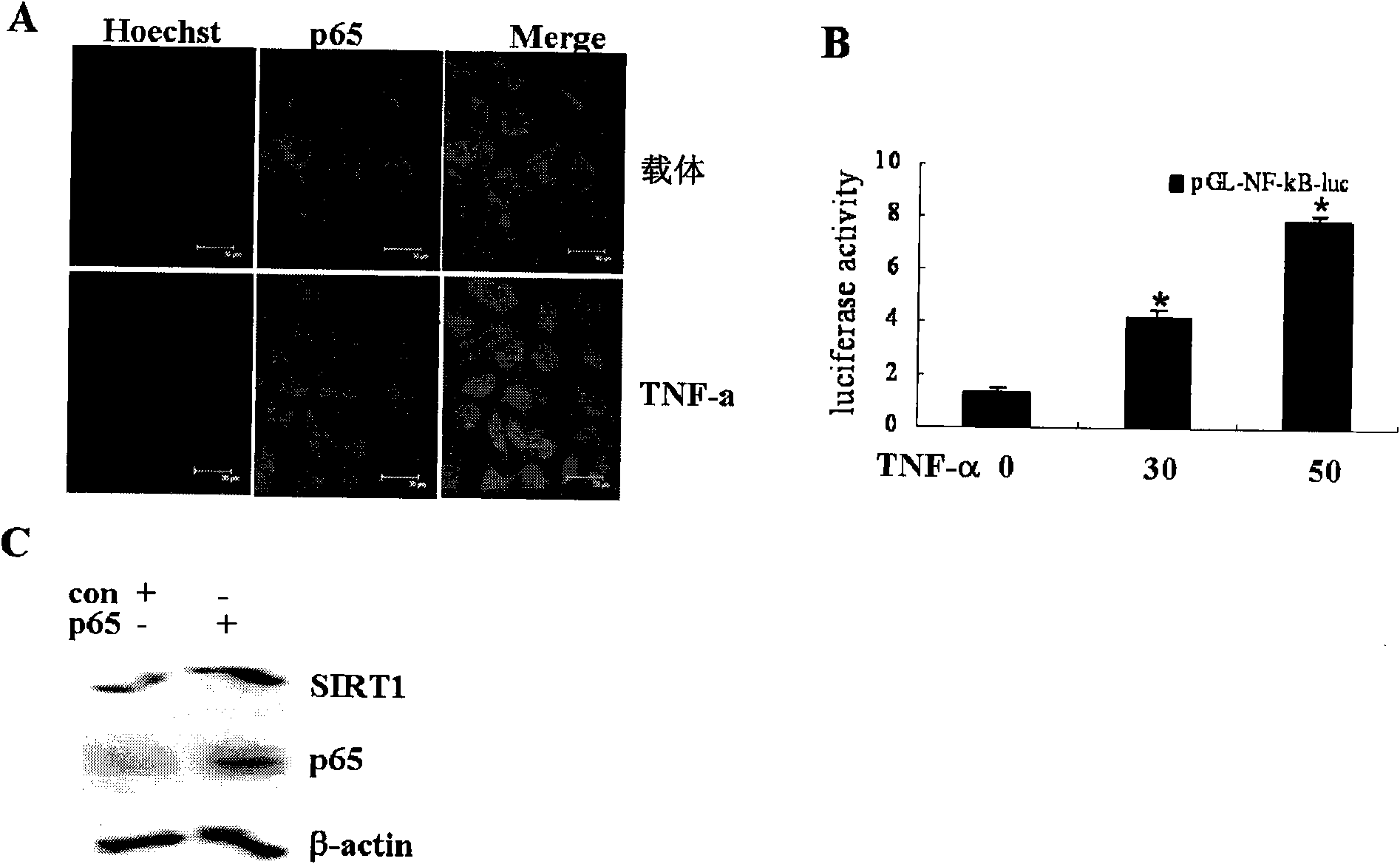 Application of p65 in preparation of medicament for up-regulating SIRT1 expression