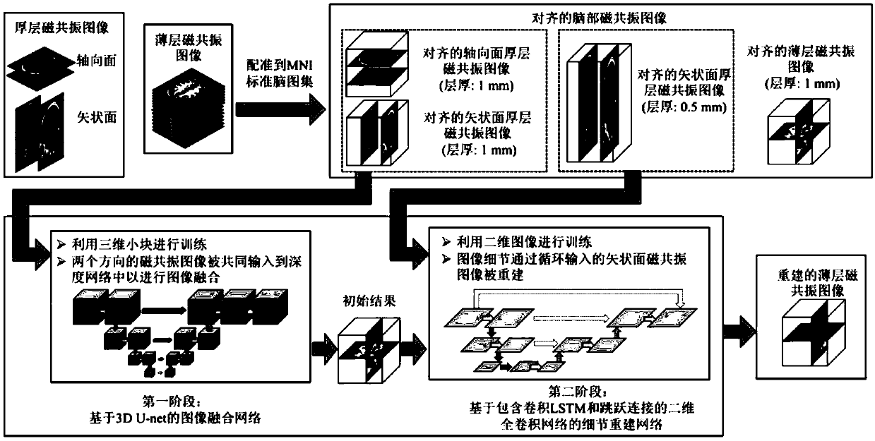 Thin layer magnetic resonance image reconstruction method based on deep learning