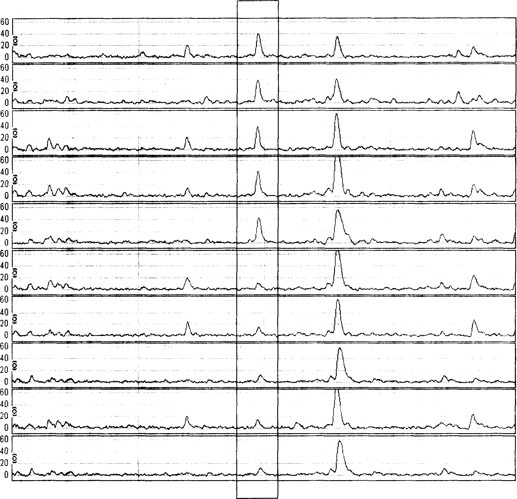 Serum protein fingerprint spectrum method for nasopharyngeal carcinoma detection