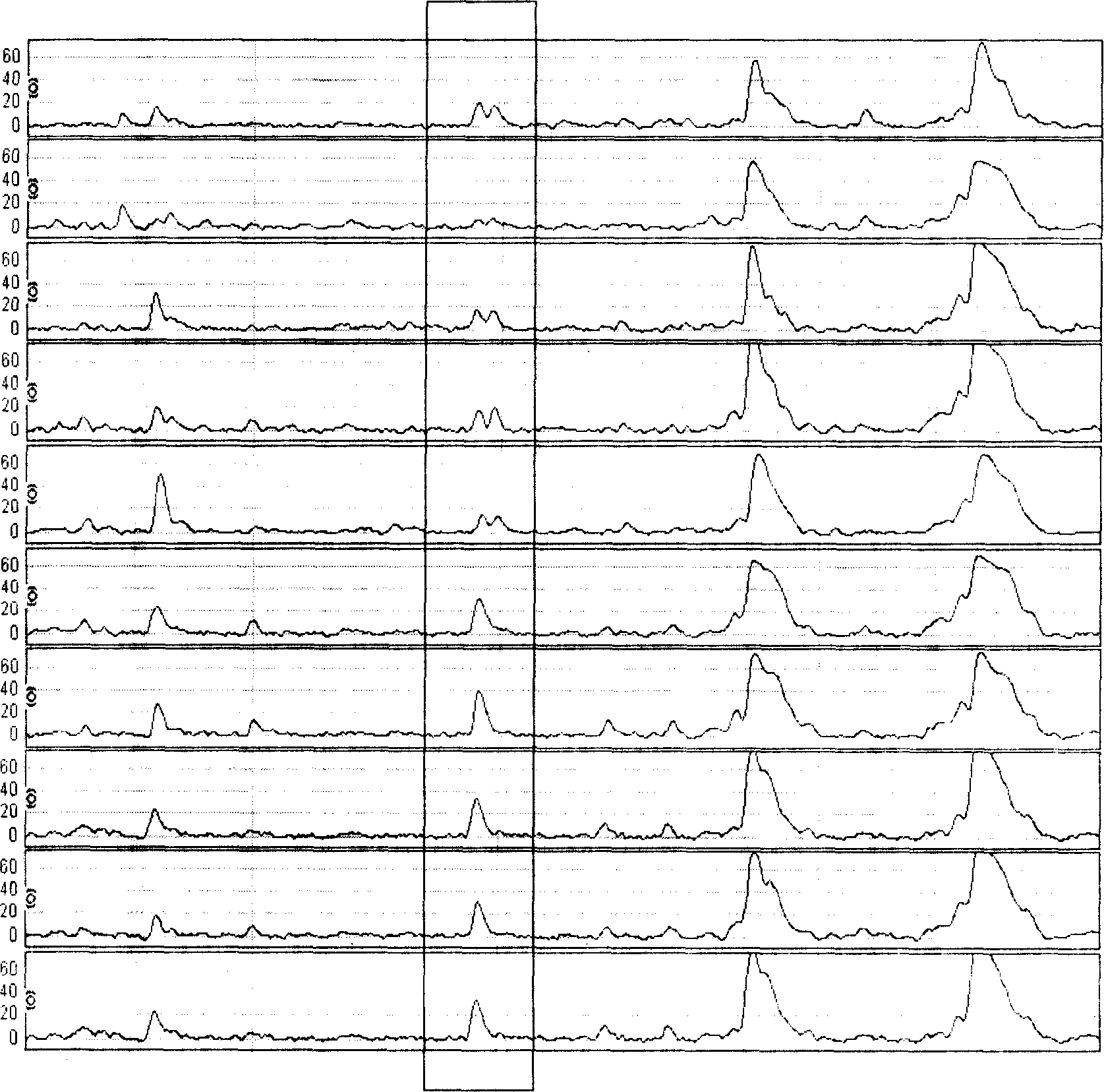 Serum protein fingerprint spectrum method for nasopharyngeal carcinoma detection