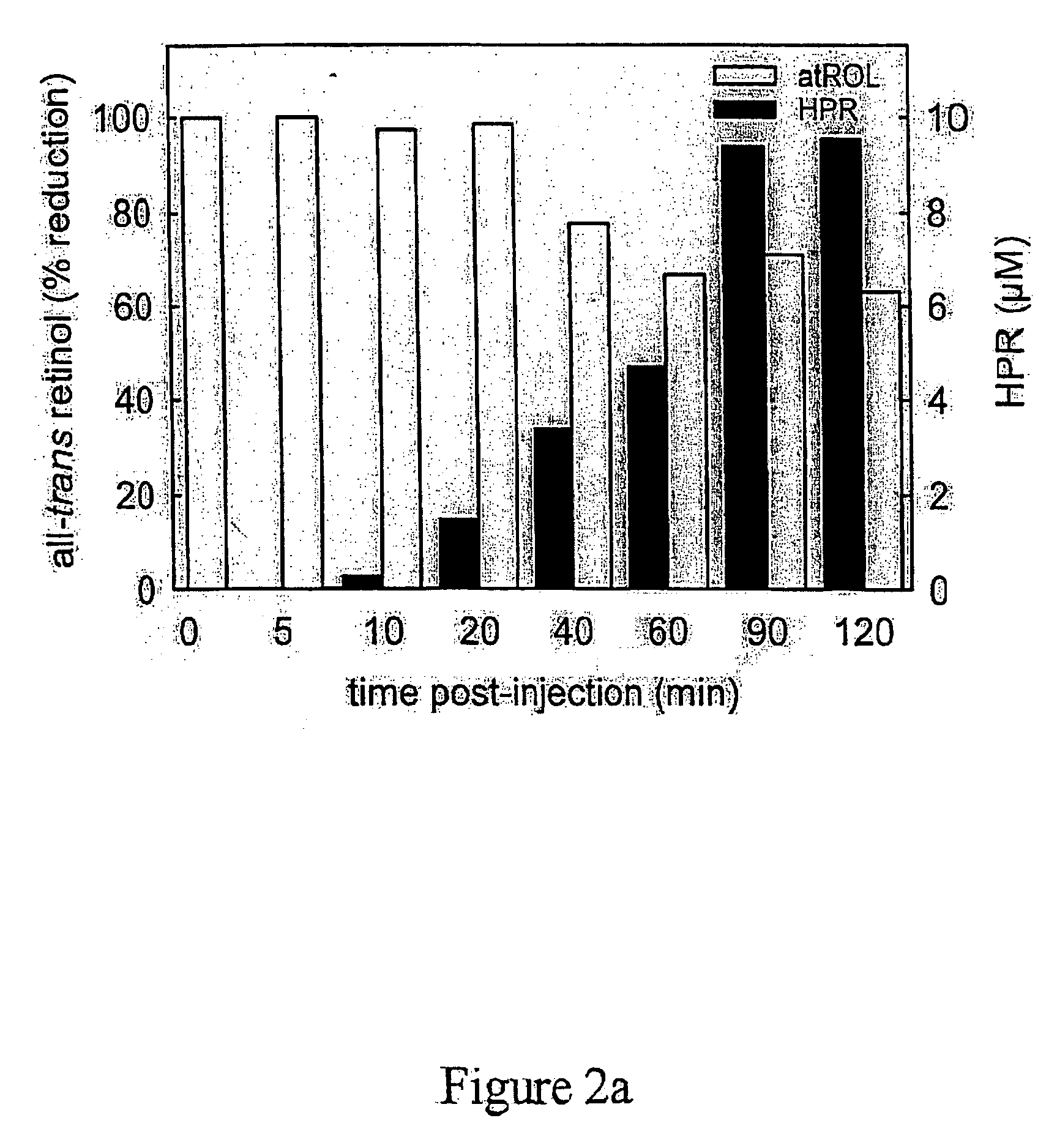 Methods and compositions for treating ophthalmic conditions via serum retinol, serum retinol binding protein (RBP), and/or serum retinol-RBP modulation