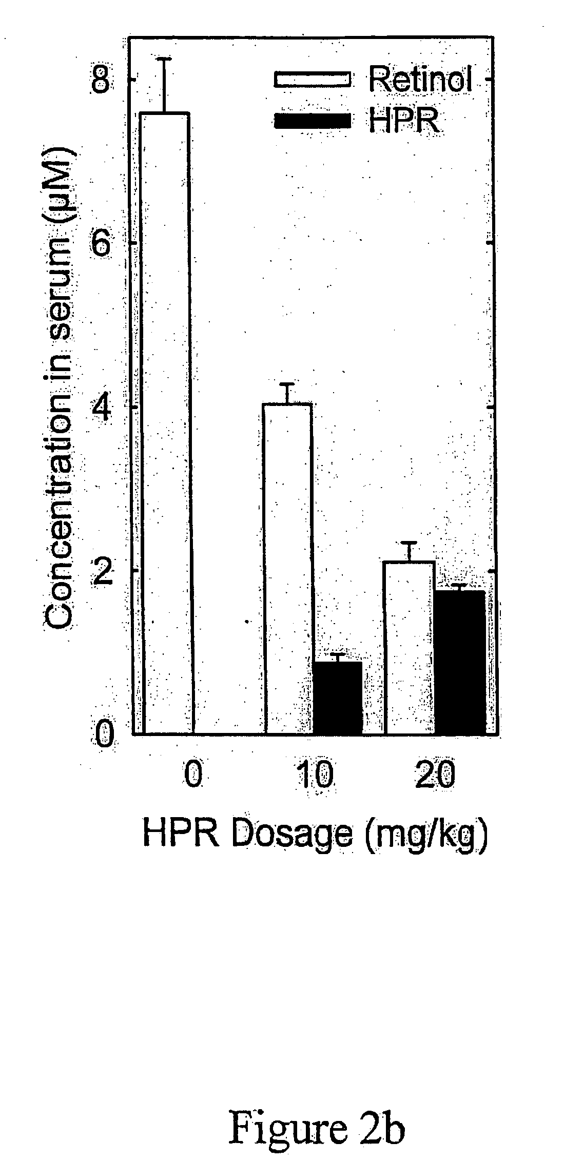 Methods and compositions for treating ophthalmic conditions via serum retinol, serum retinol binding protein (RBP), and/or serum retinol-RBP modulation