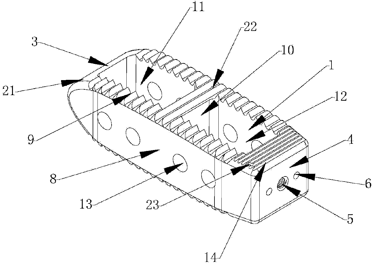 Minimally invasive lateral approach interbody fusion device