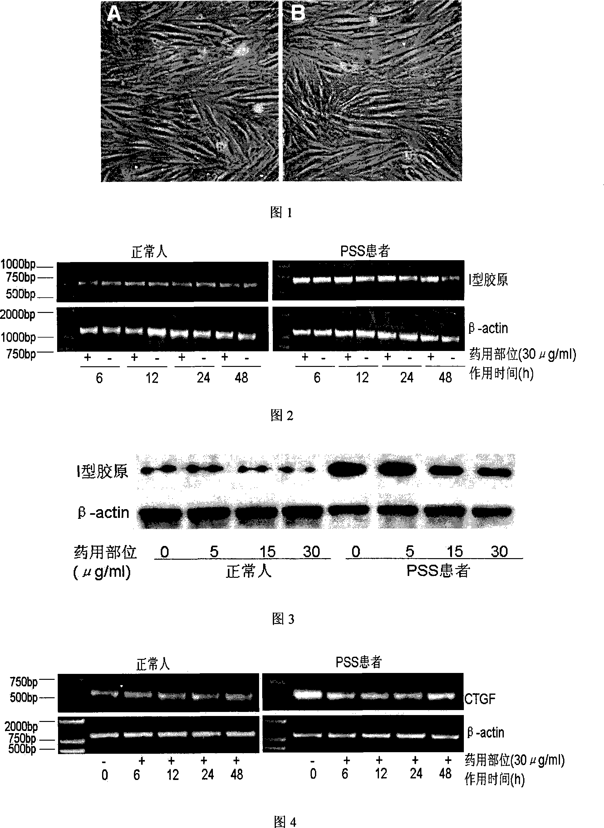 Method for preparing valid target in gavel fruit vine fruit and application of the same