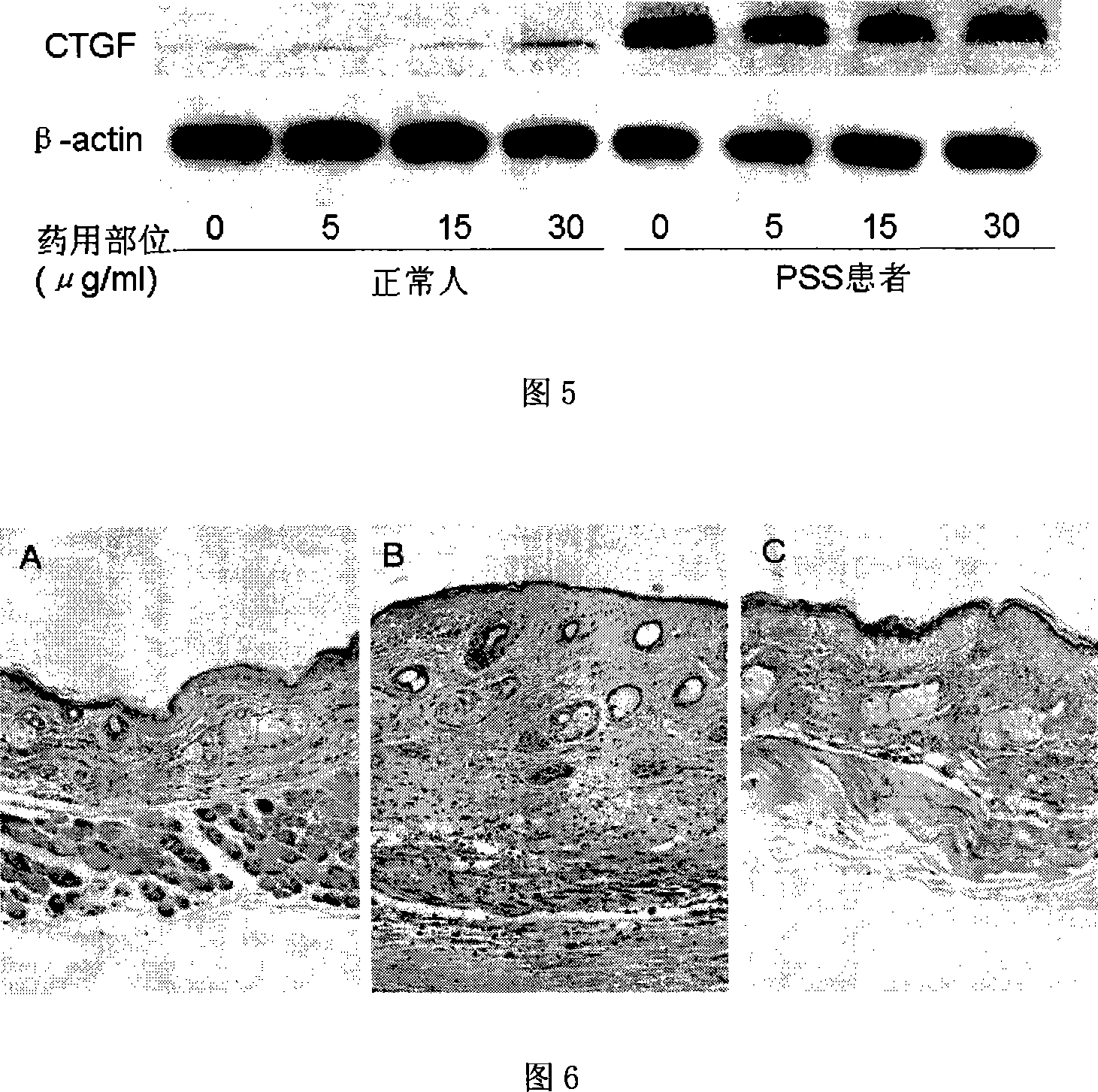 Method for preparing valid target in gavel fruit vine fruit and application of the same