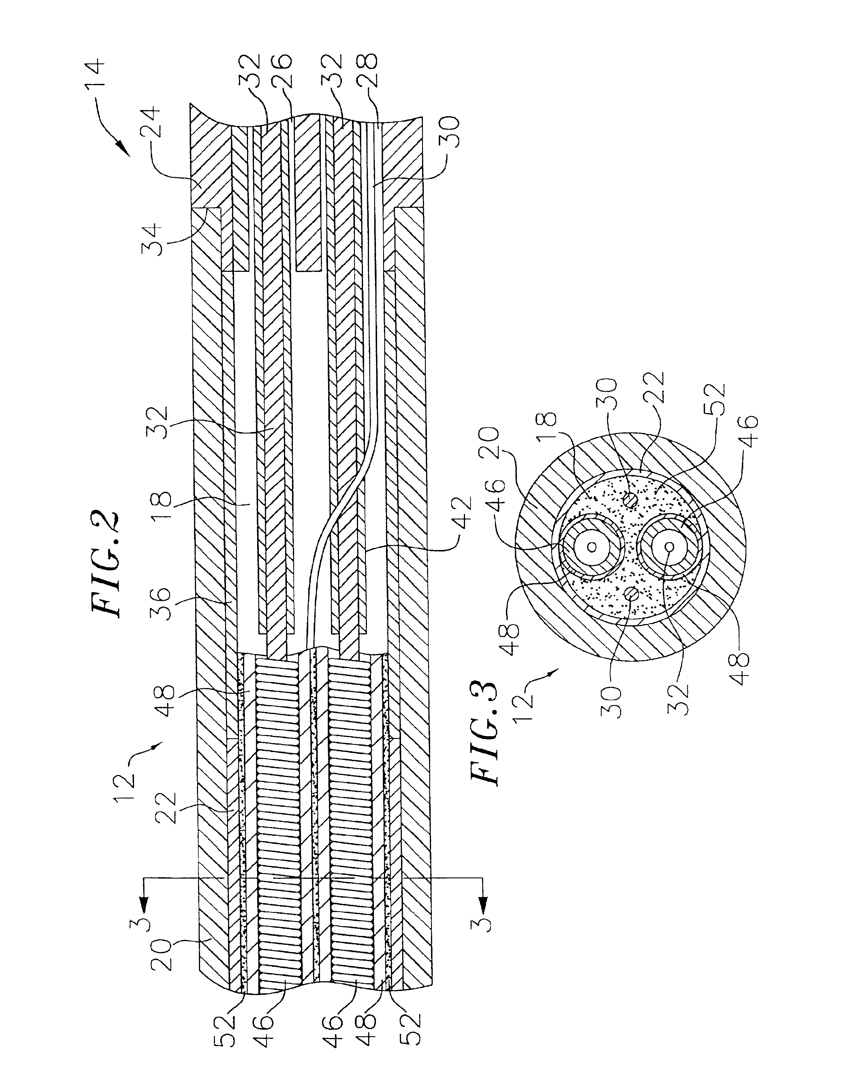 Steerable catheter with reinforced tip