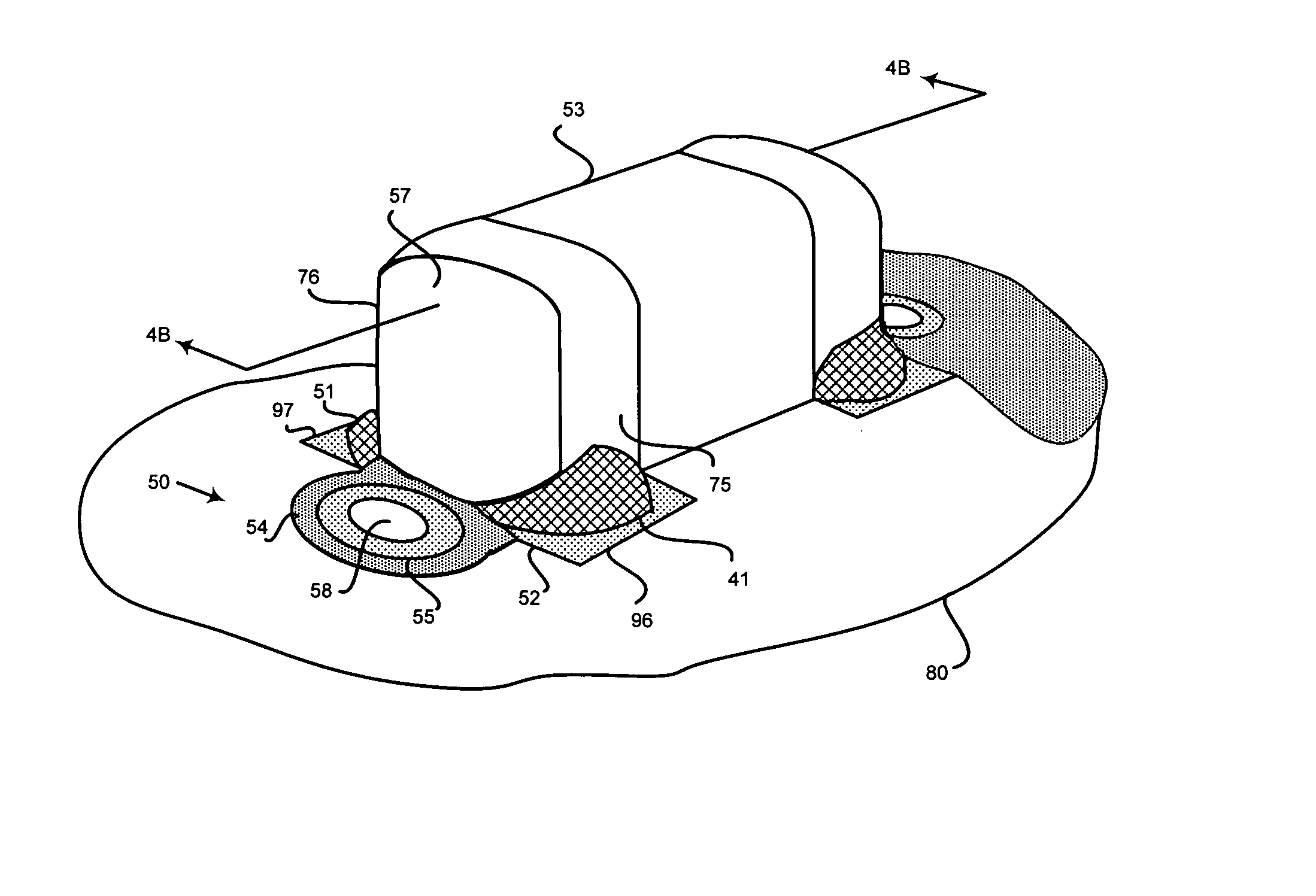 Substrate with via and pad structures