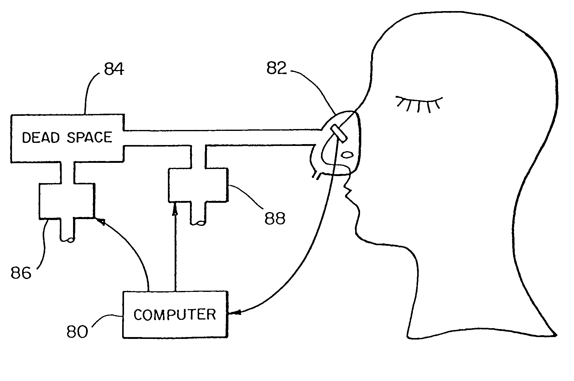 Ventilatory stabilization technology