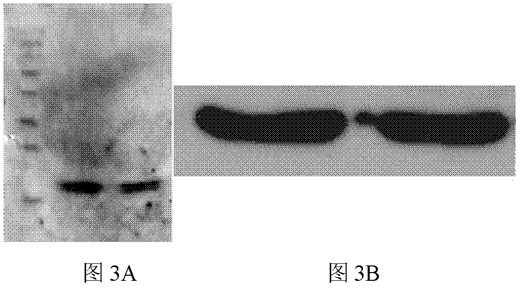 HCV (hepatitis C virus) core antigen and antibody thereof as well as hybridoma cell lines secreting antibody