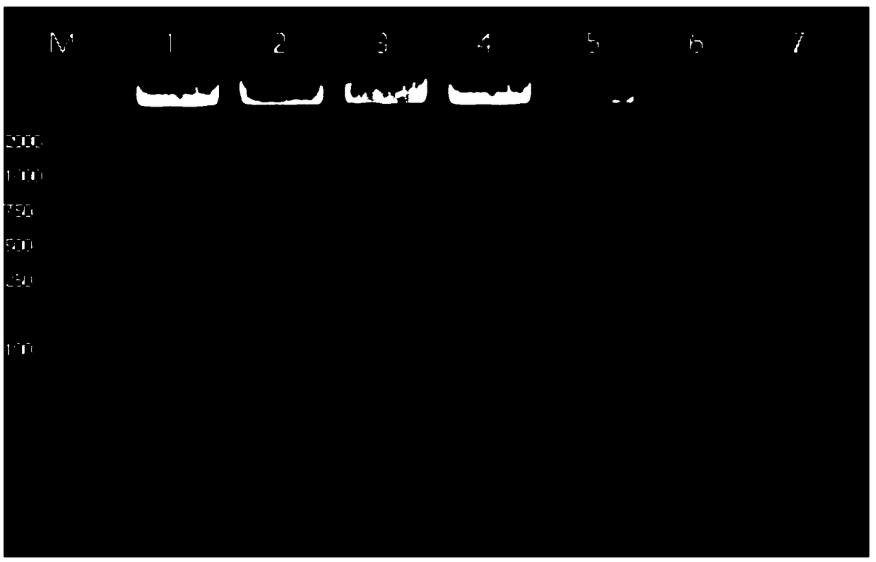 Method for rapid detection of postoperative intracranial bacterial infection by multiple real-time fluorescent PCR (Polymerase Chain Reaction)