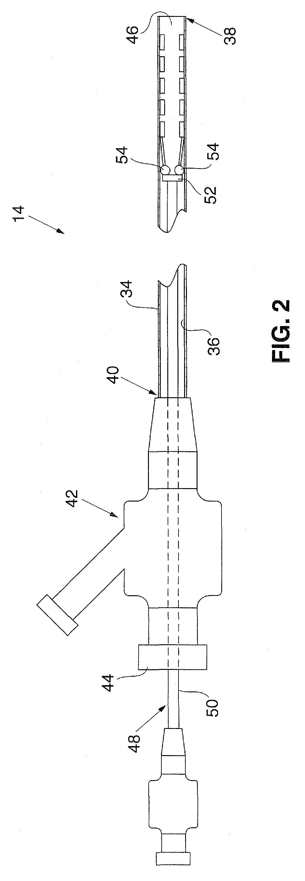 System and method for treating ischemic stroke