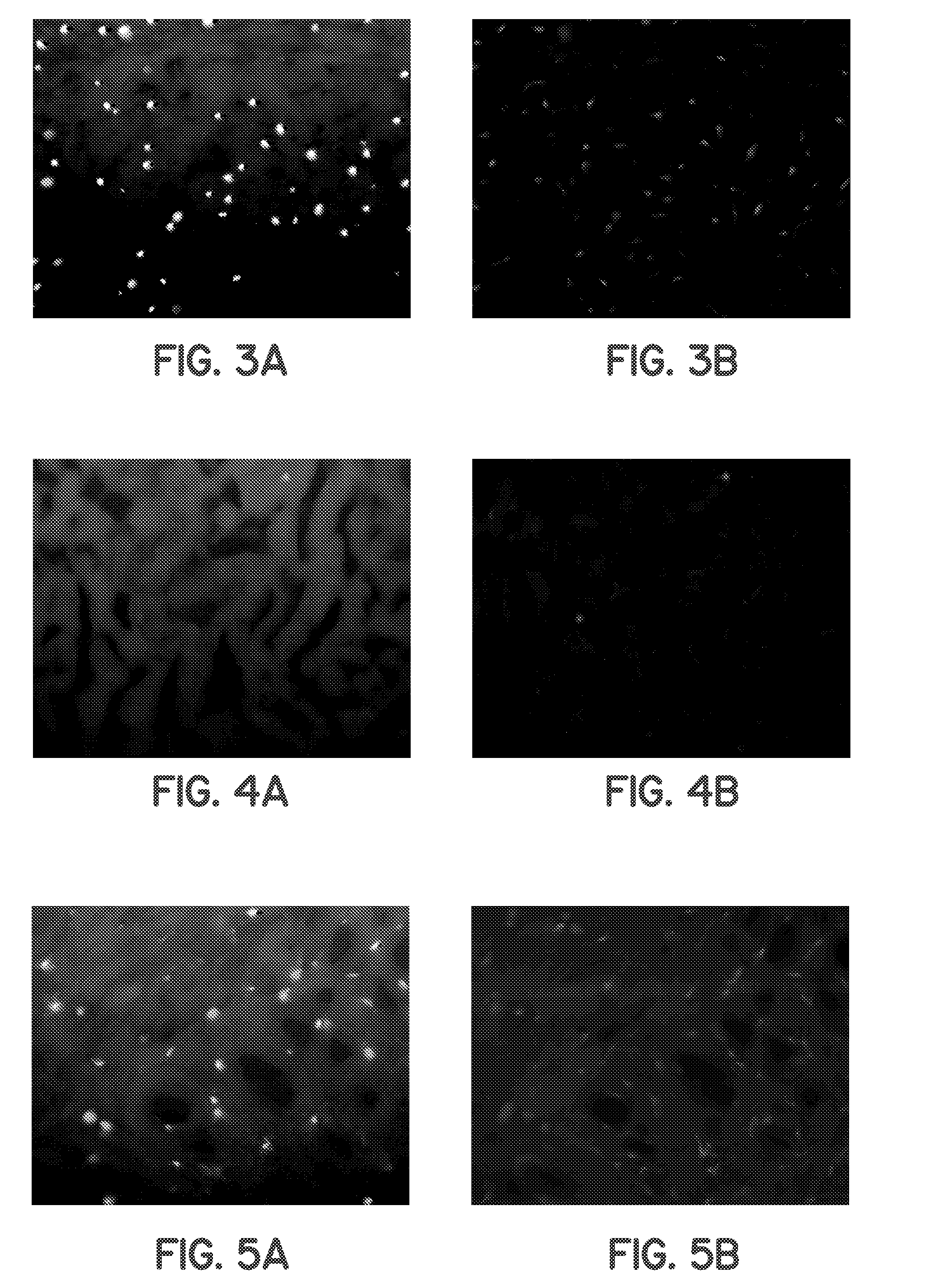 Tissue processing for nonimmunogenic implants