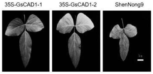 Mosaic-virus resistance GsCAD1 gene separated from wild soybeans, encoded protein and application of GsCAD1 gene