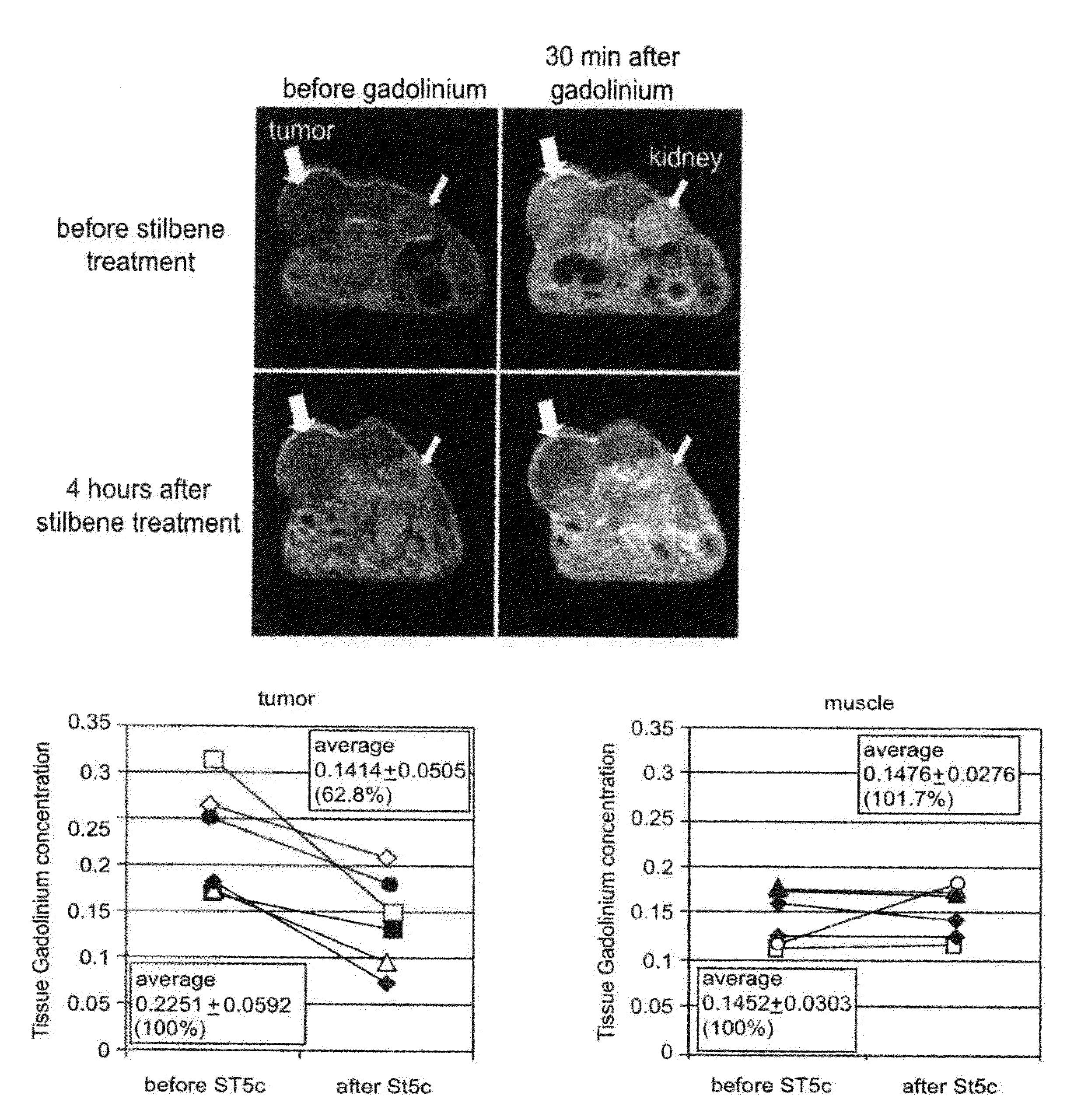 Induction of tumor hypoxia for cancer therapy