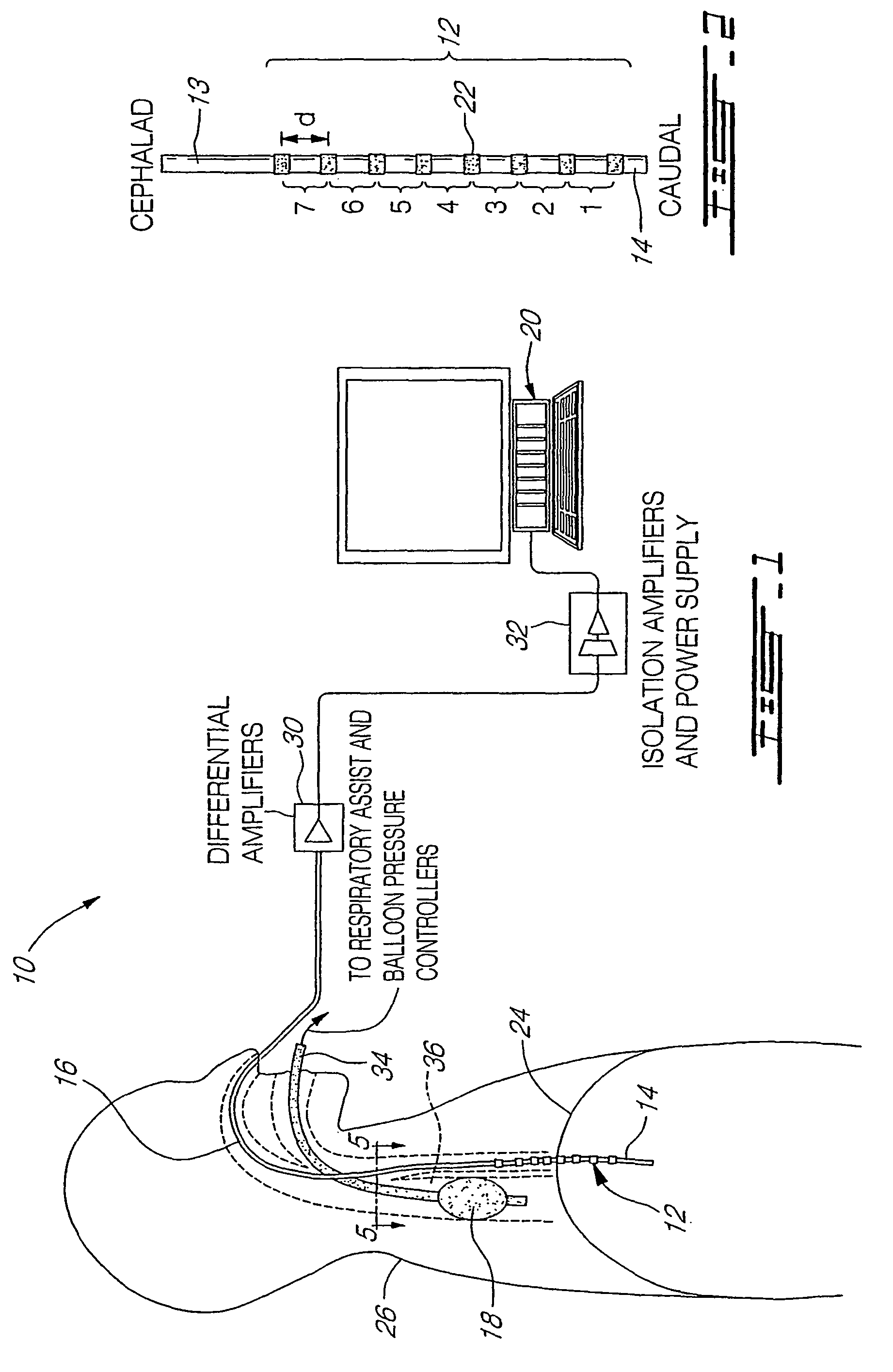 Myoelectrically activated respiratory leak sealing