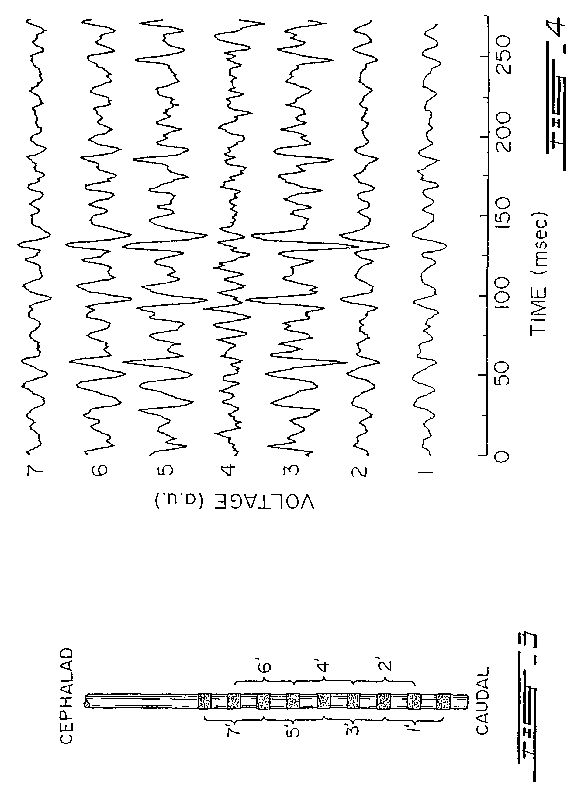 Myoelectrically activated respiratory leak sealing