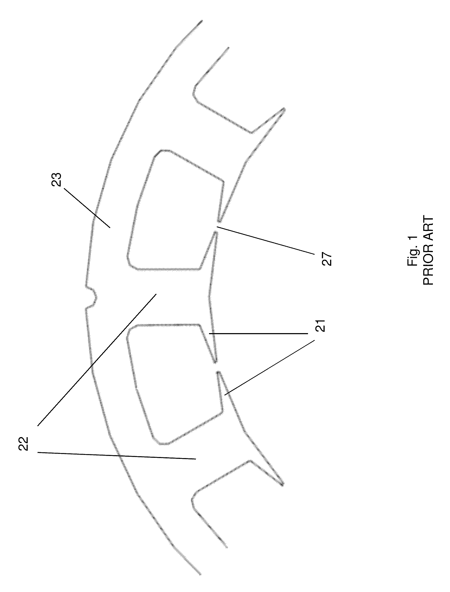 Low-cost low-cog PM machine