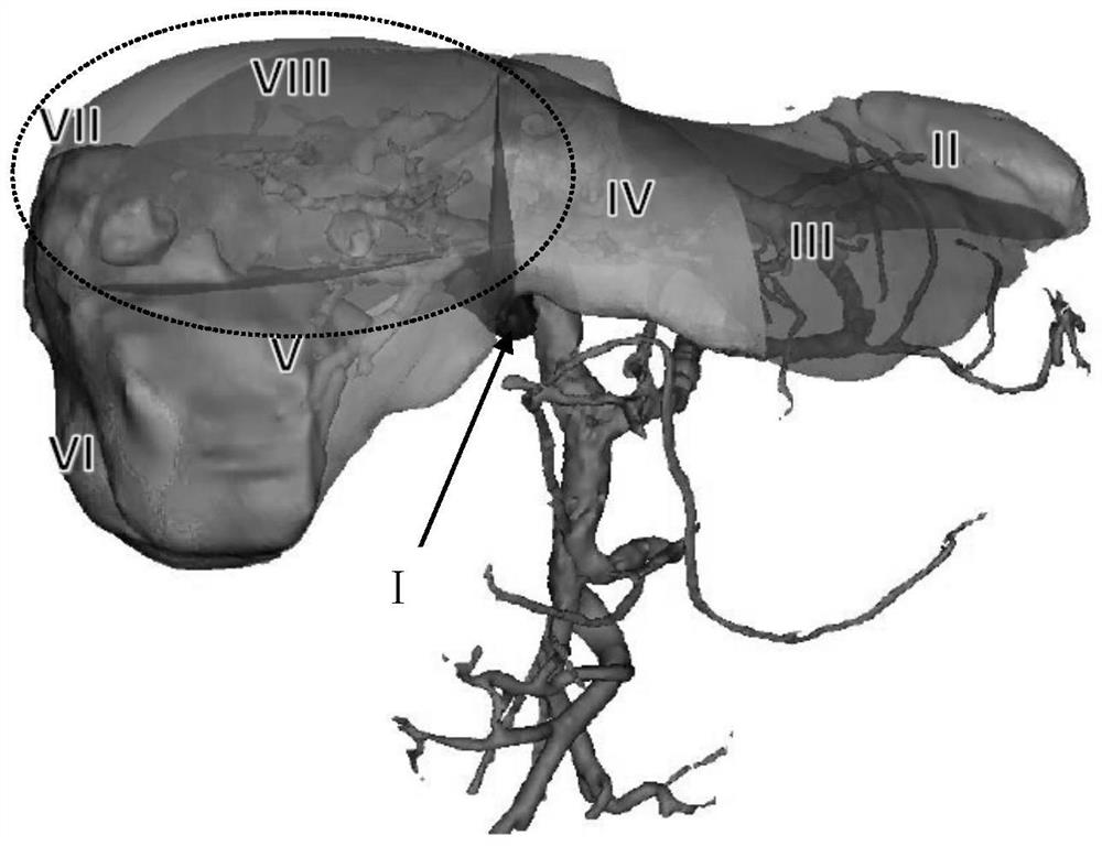 Method for representing residual liver proportion in liver resection operation