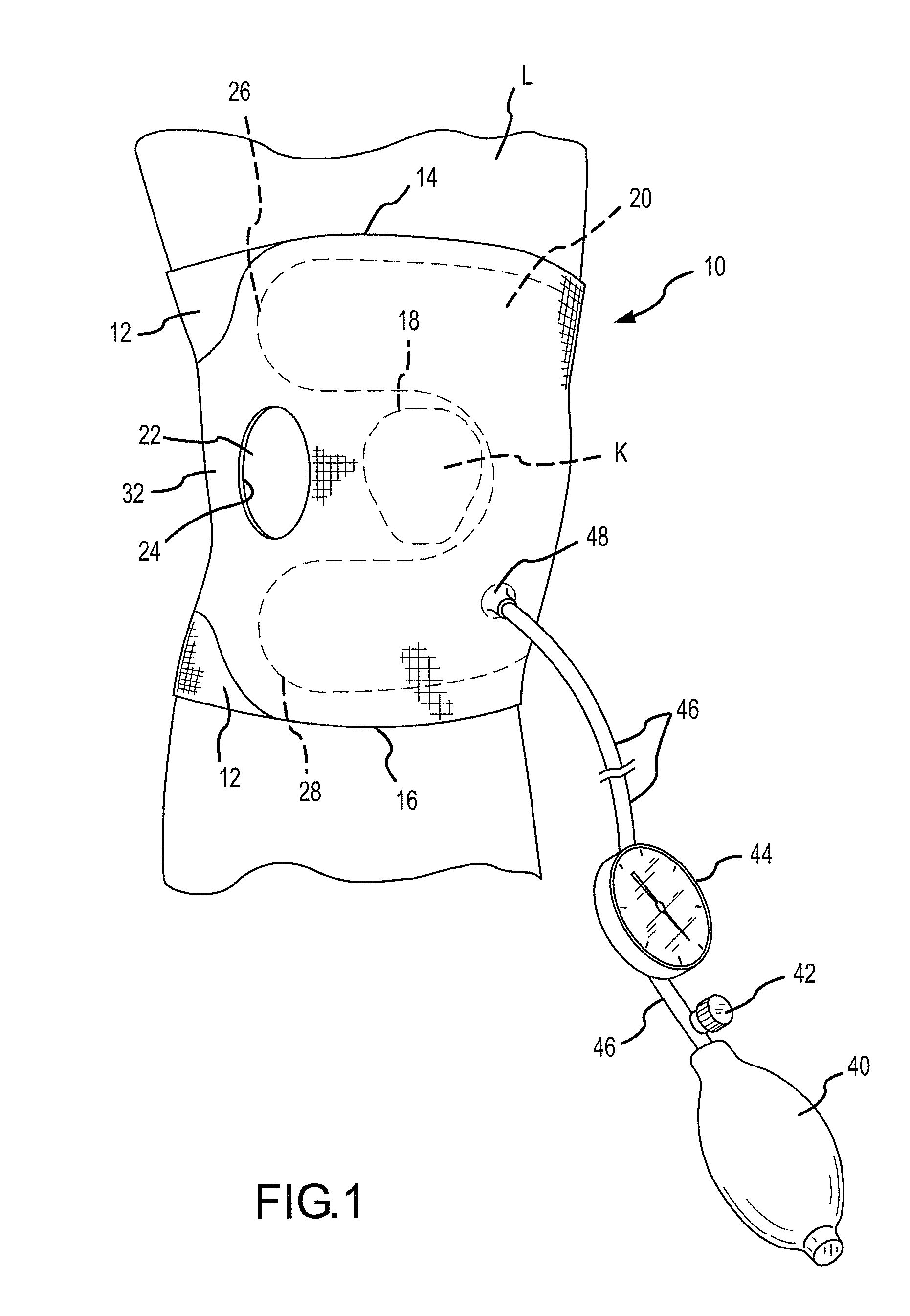 Joint Aspirate Facilitating Device