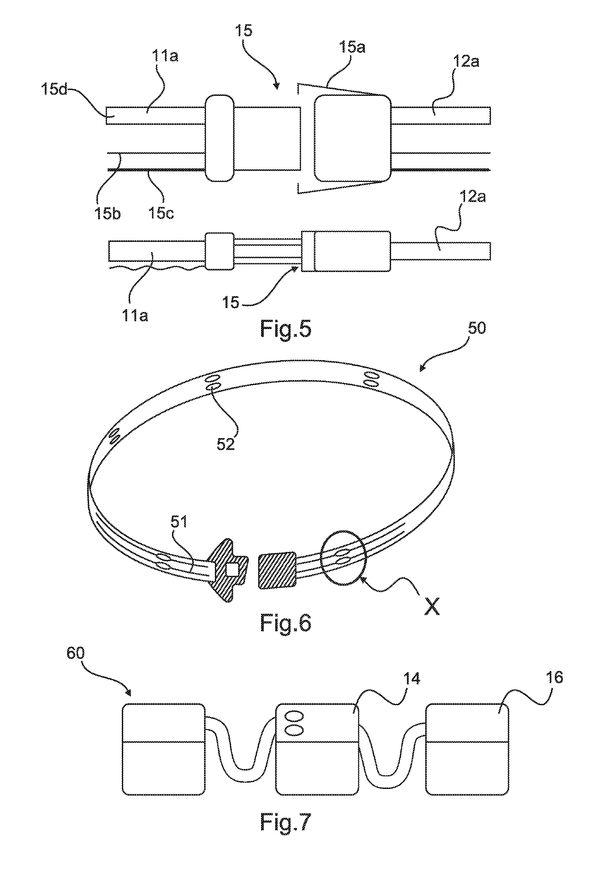 Exoskeleton System