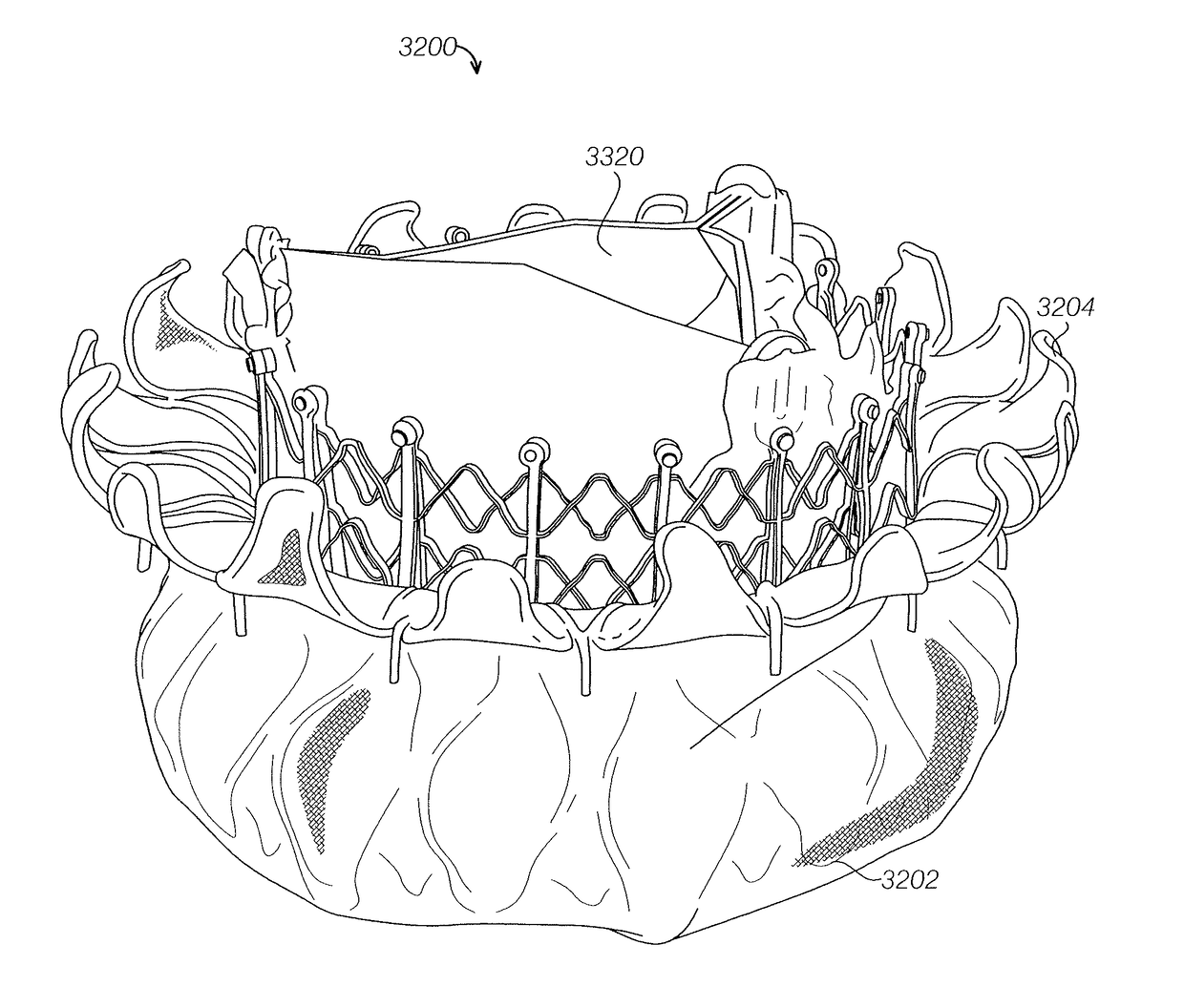 Replacement mitral valves